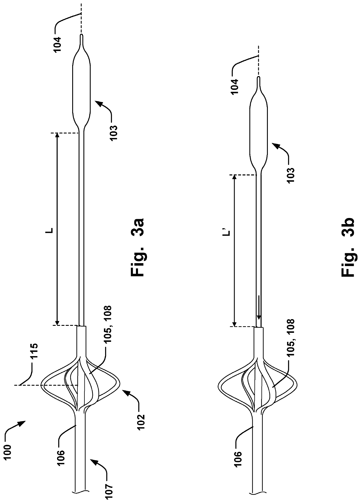 Medical System for Annuloplasty