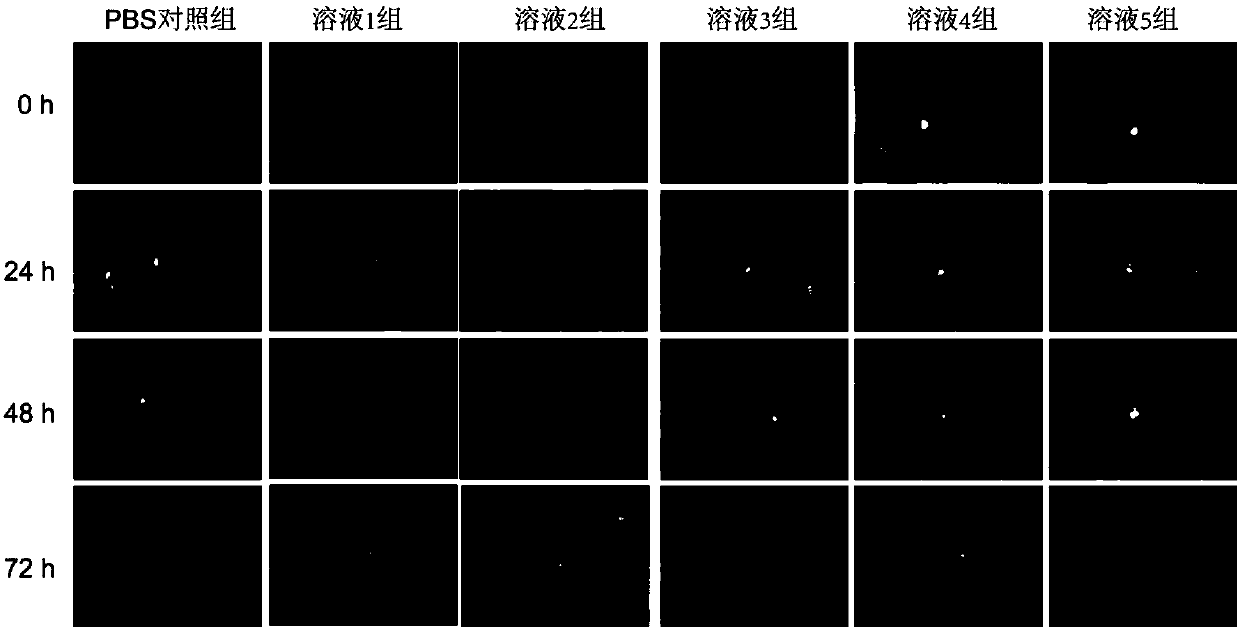 Myricetin micelle eye drops with synergistic effect and preparation method of myricetin micelle eye drops