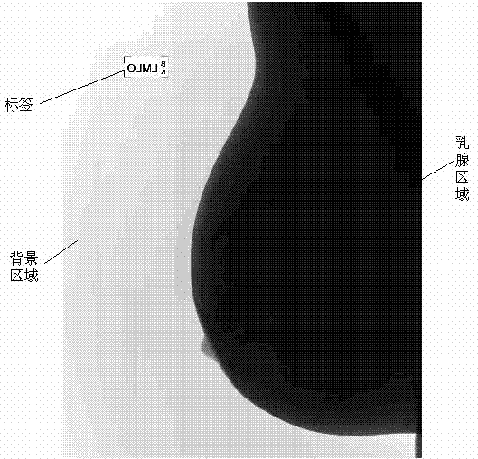 Preprocessing method and preprocessing system used for extracting breast regions in mammographic images