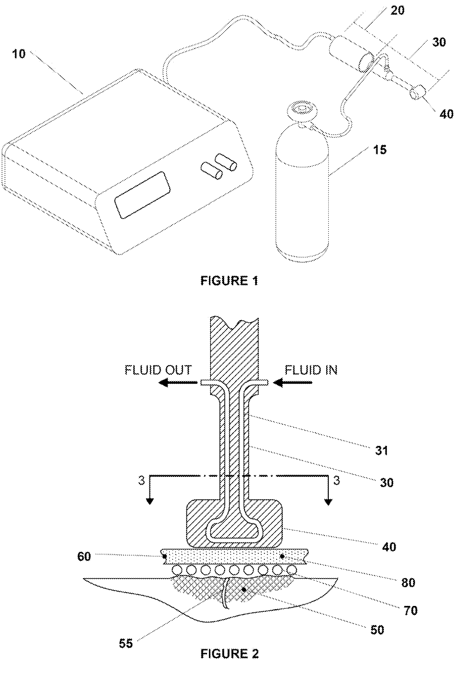 Ultrasound assisted tissue welding device