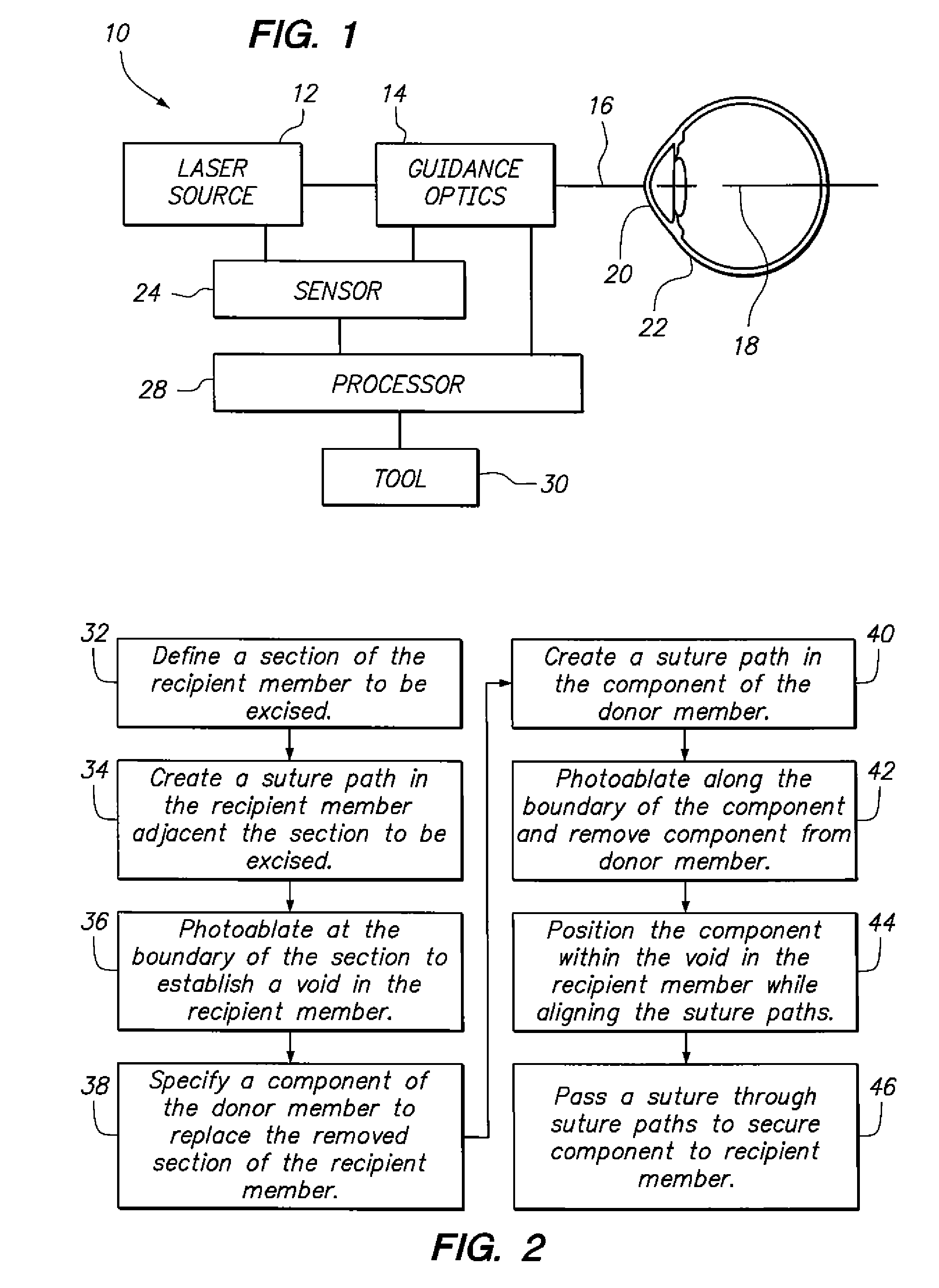 System and method for creating suture channels