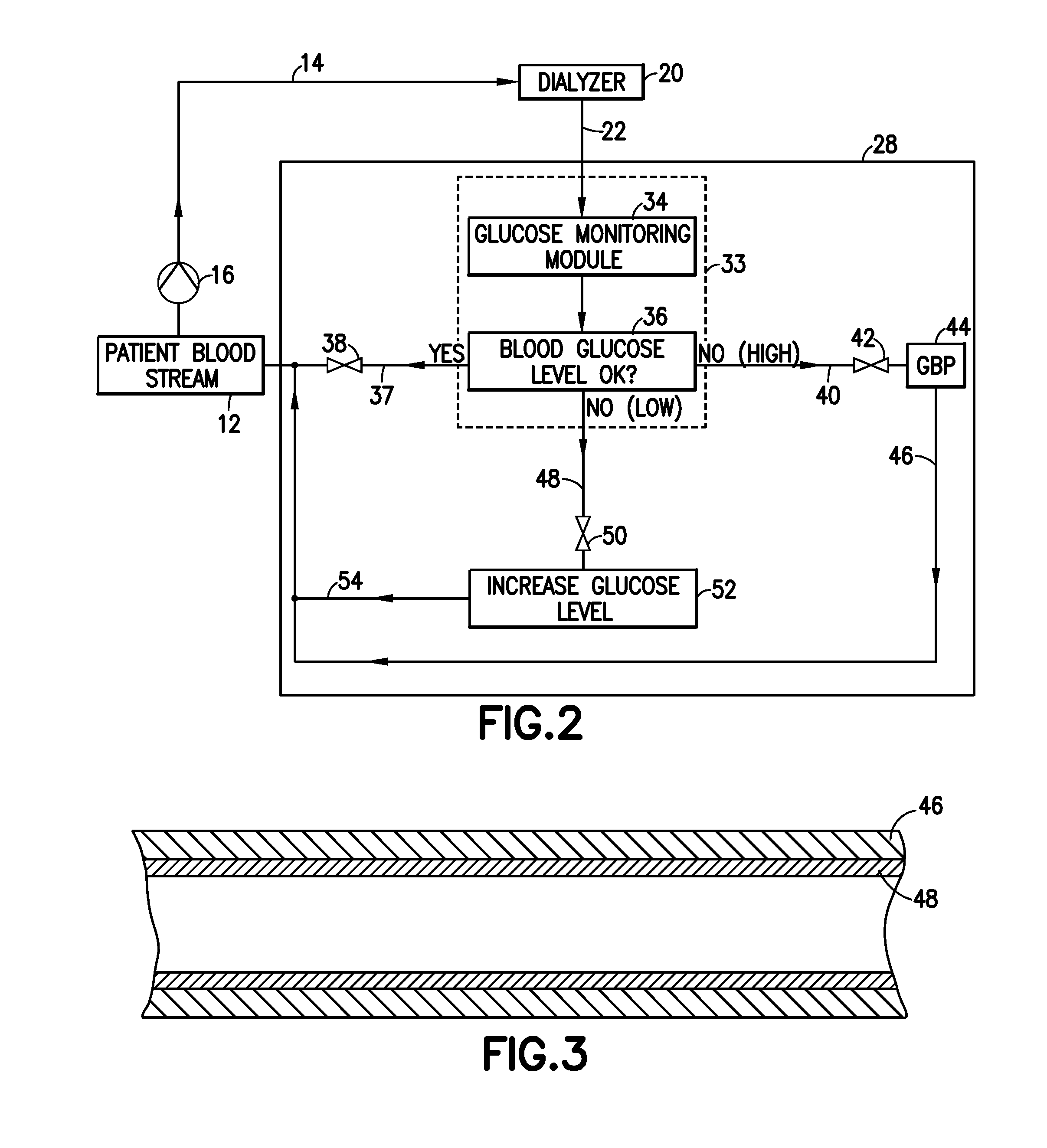 Glucose management and dialysis method and apparatus