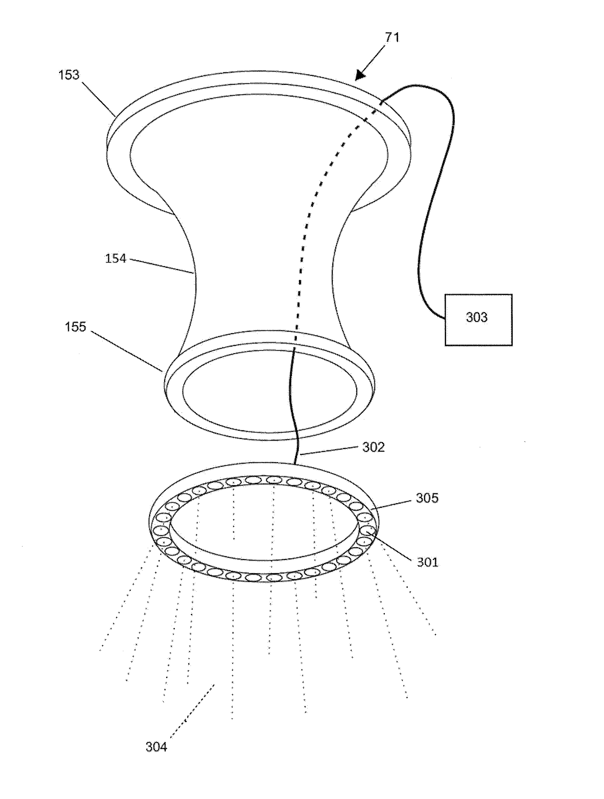 Circumferential wound retraction with support and guidance structures