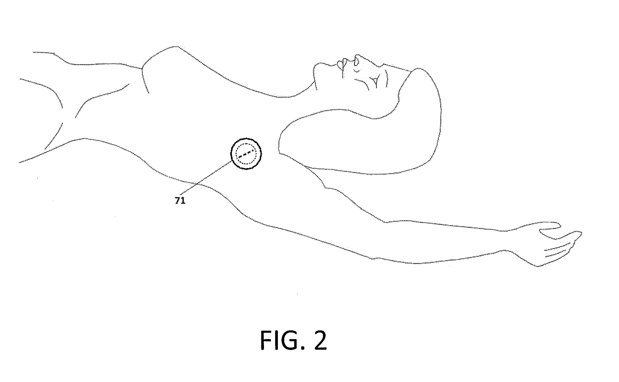 Circumferential wound retraction with support and guidance structures