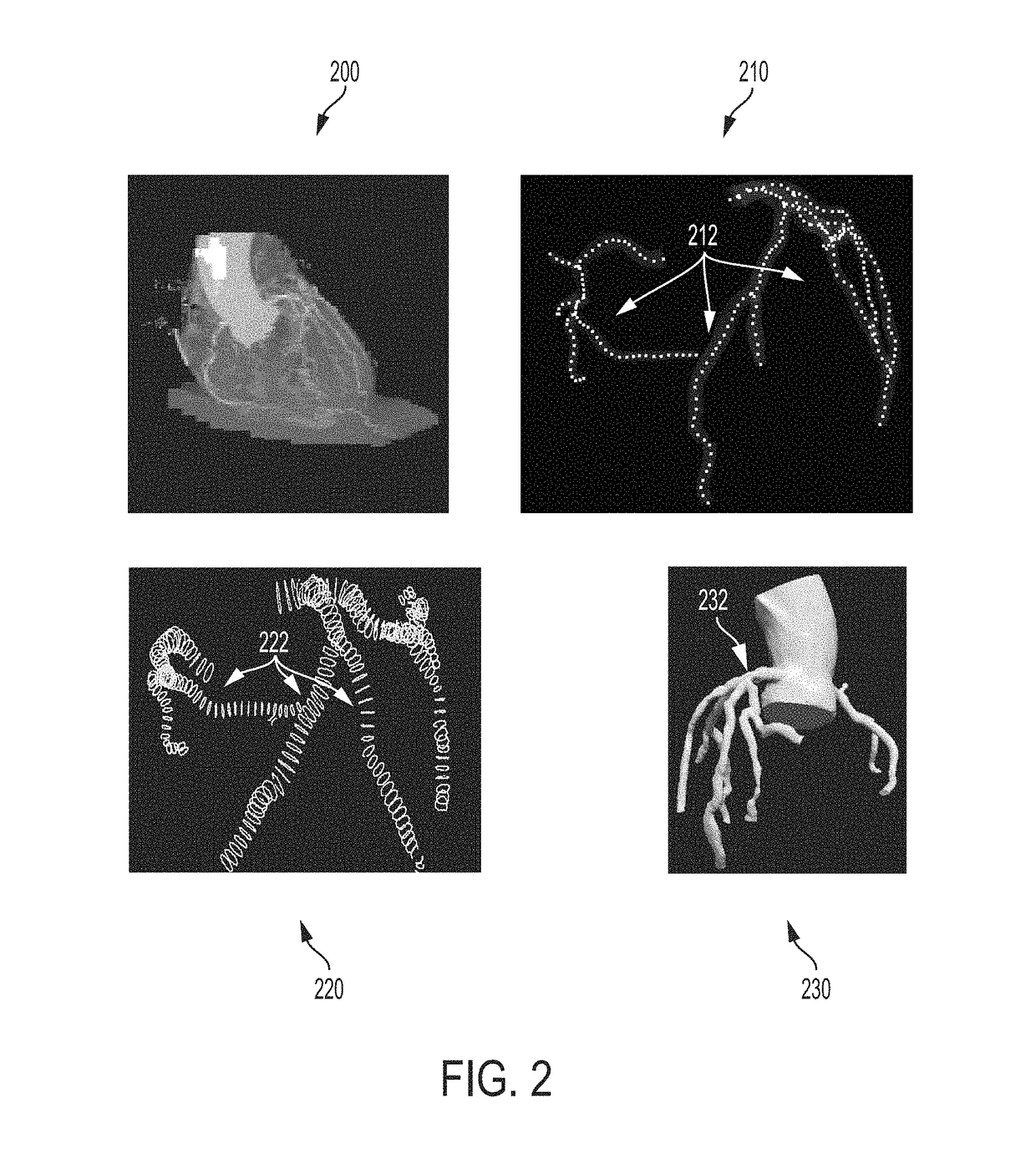 Method and system for automated therapy planning for arterial stenosis