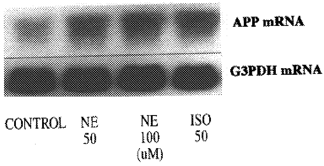 Composition and methods for treatment of neurological disorders and neurodegenerative diseases