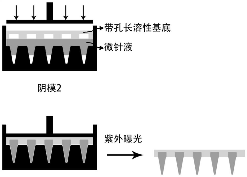 Microneedle patch for improving skin acne and preparation method thereof