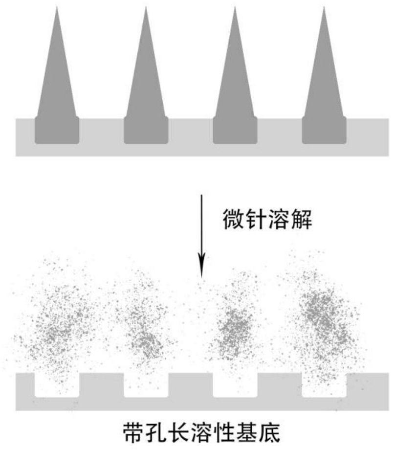 Microneedle patch for improving skin acne and preparation method thereof