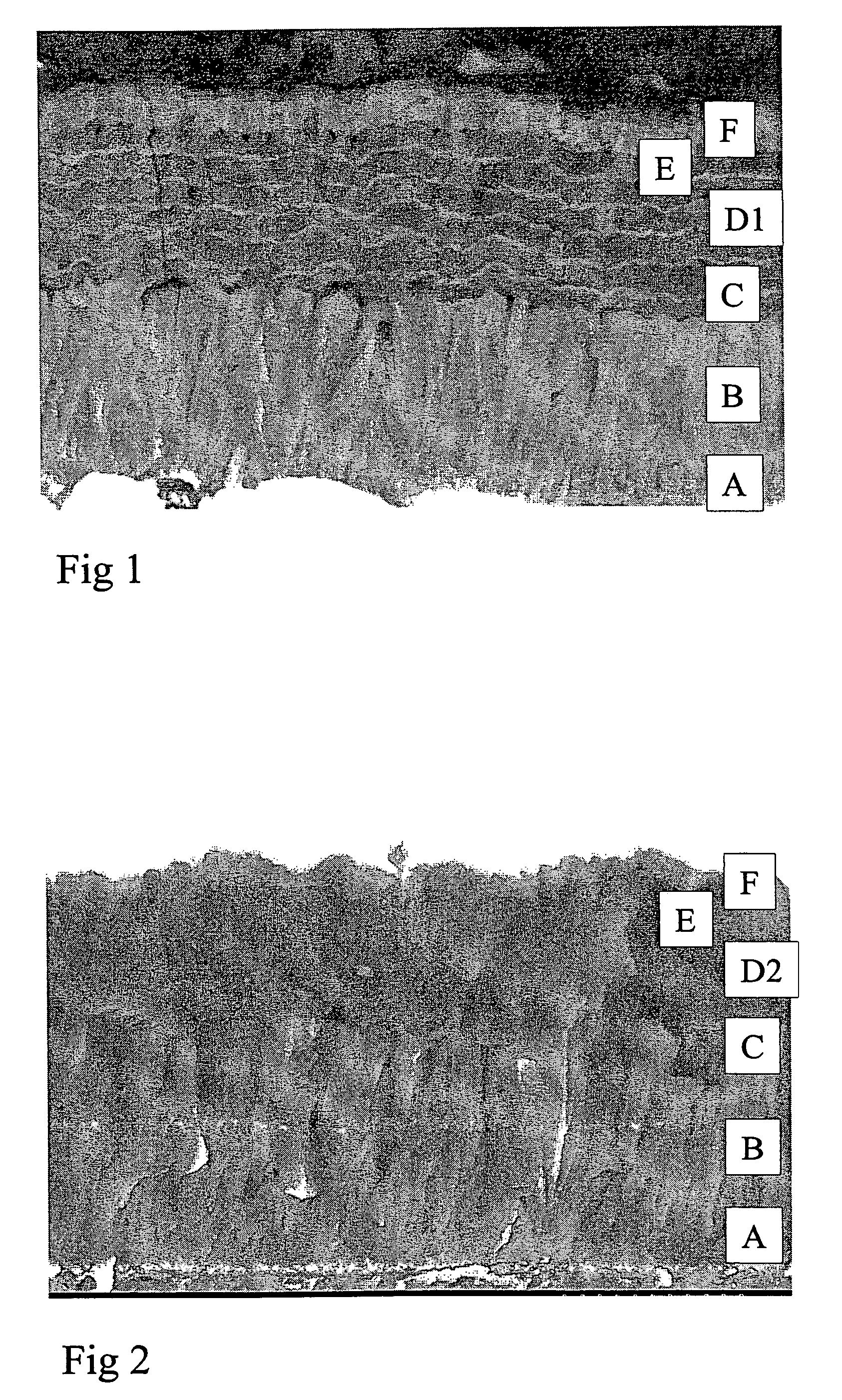 Coated insert and method of making same