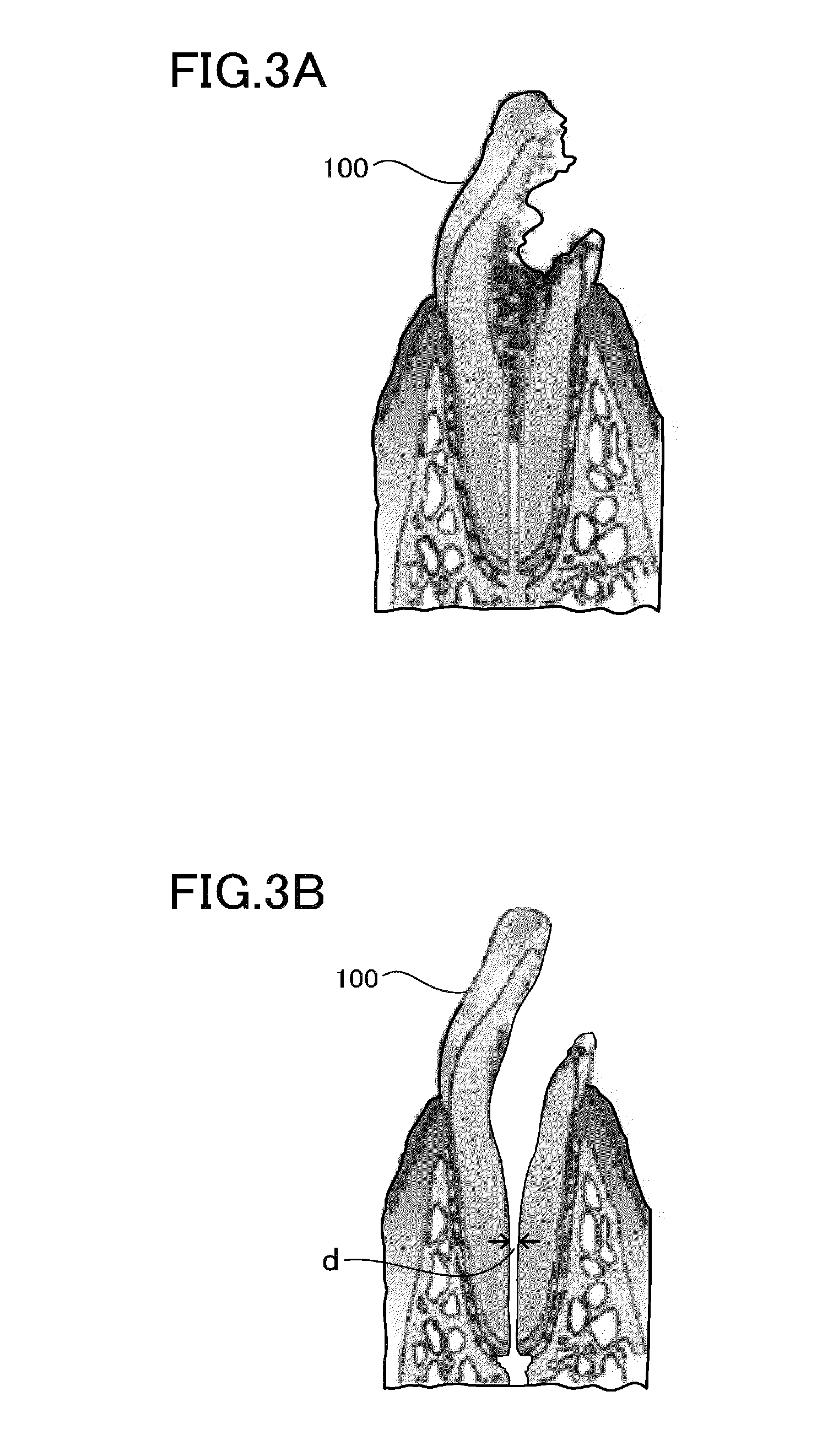 Unextracted tooth root canal filler and dental tissue regeneration method for unextracted tooth