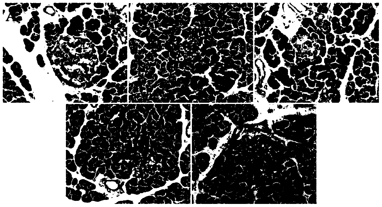 Application of callicarpa nudiflora extract in preparing hypoglycemic drug or health care product