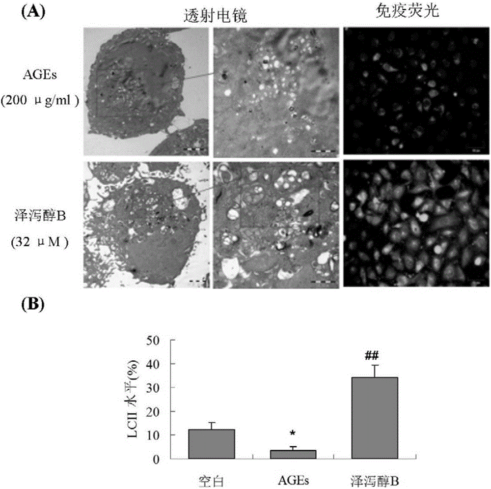 Autophagy revulsive for diabetic vascular complication treatment and application in medicine