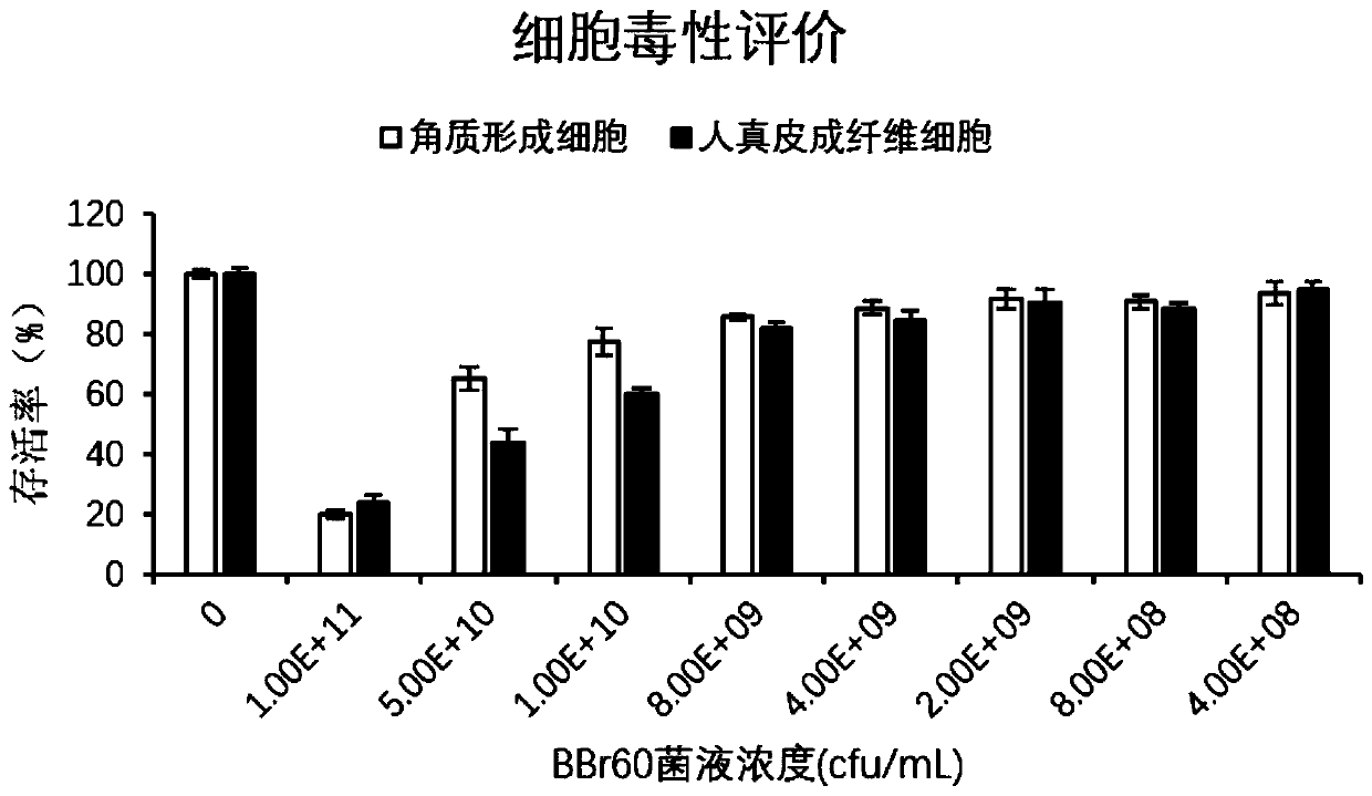 Bifidobacterium breve with effects of repairing ultraviolet injury, relieving inflammation and preventing skin light aging, and preparation method and application thereof
