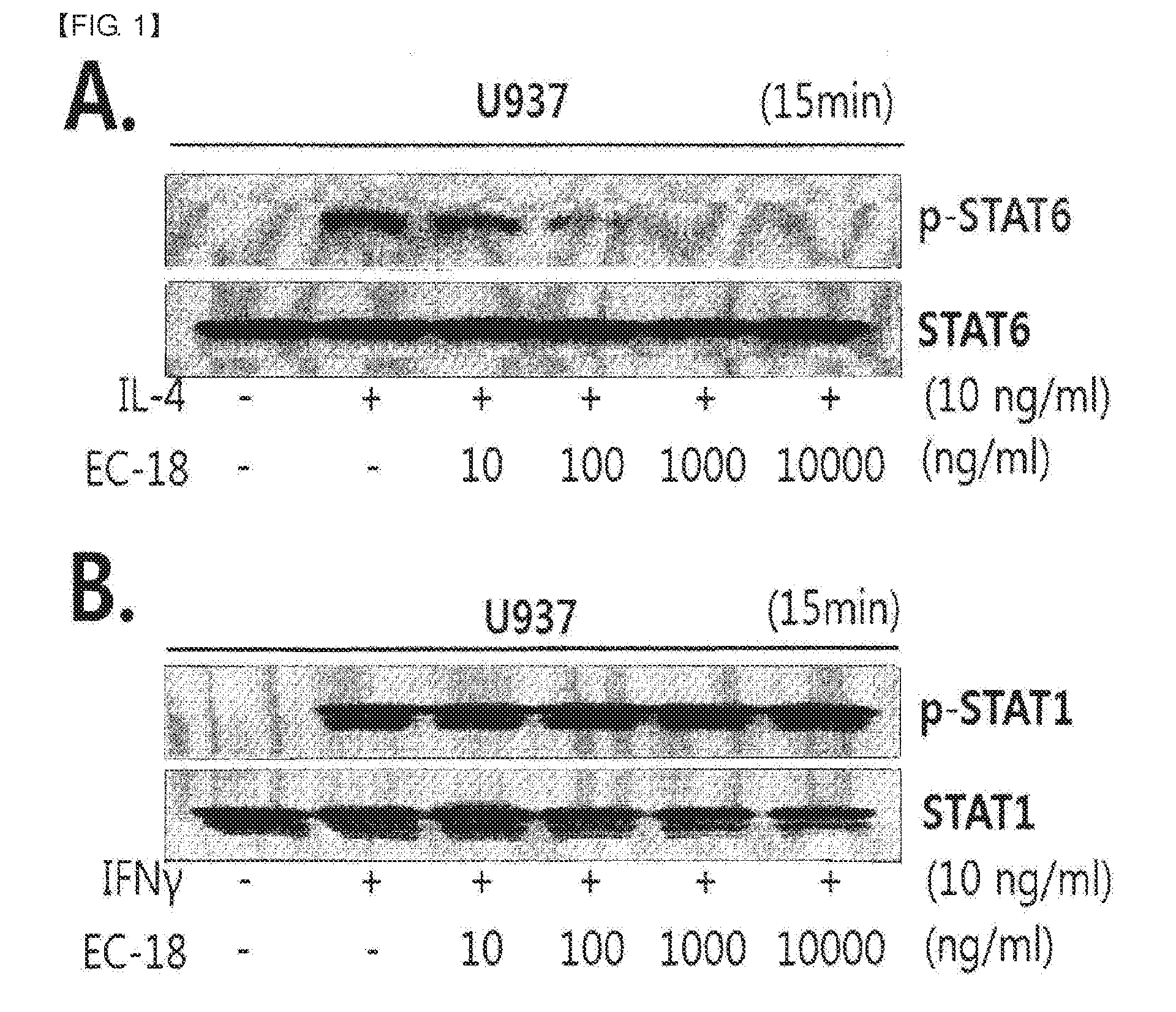 Composition containing monoacetyldiacylglycerol compound as active ingredient for inhibiting blood cancer or metastasis