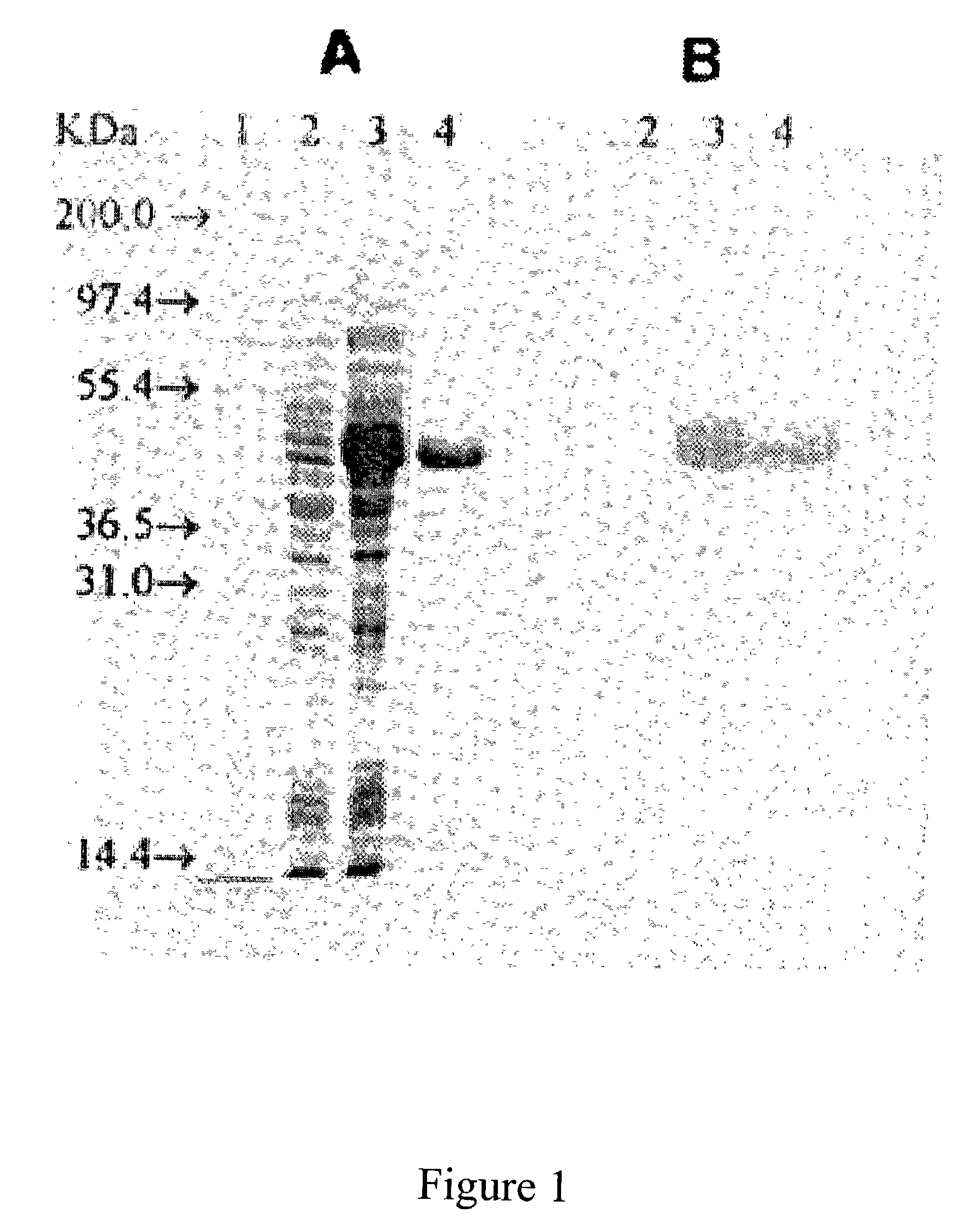 Mutant-type lipases and applications thereof