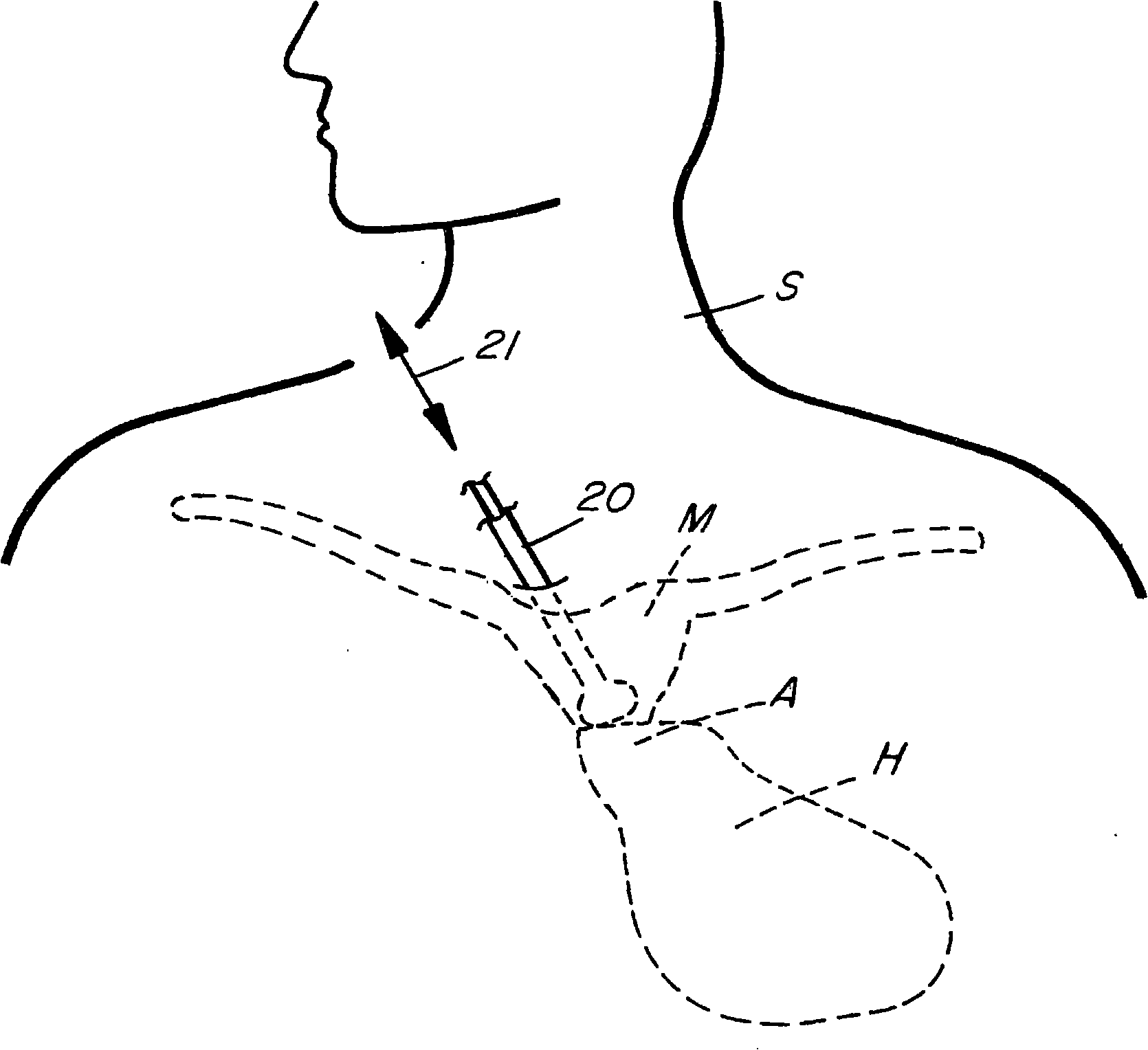 Methods and apparatus for monitoring heart impulses