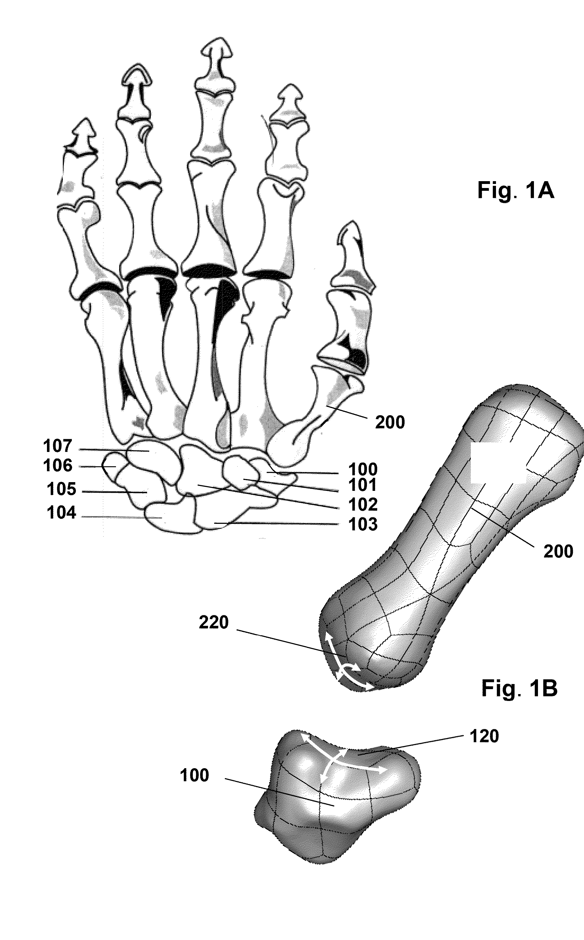 Devices, implements and methods for the treatment of a multi-axis joint