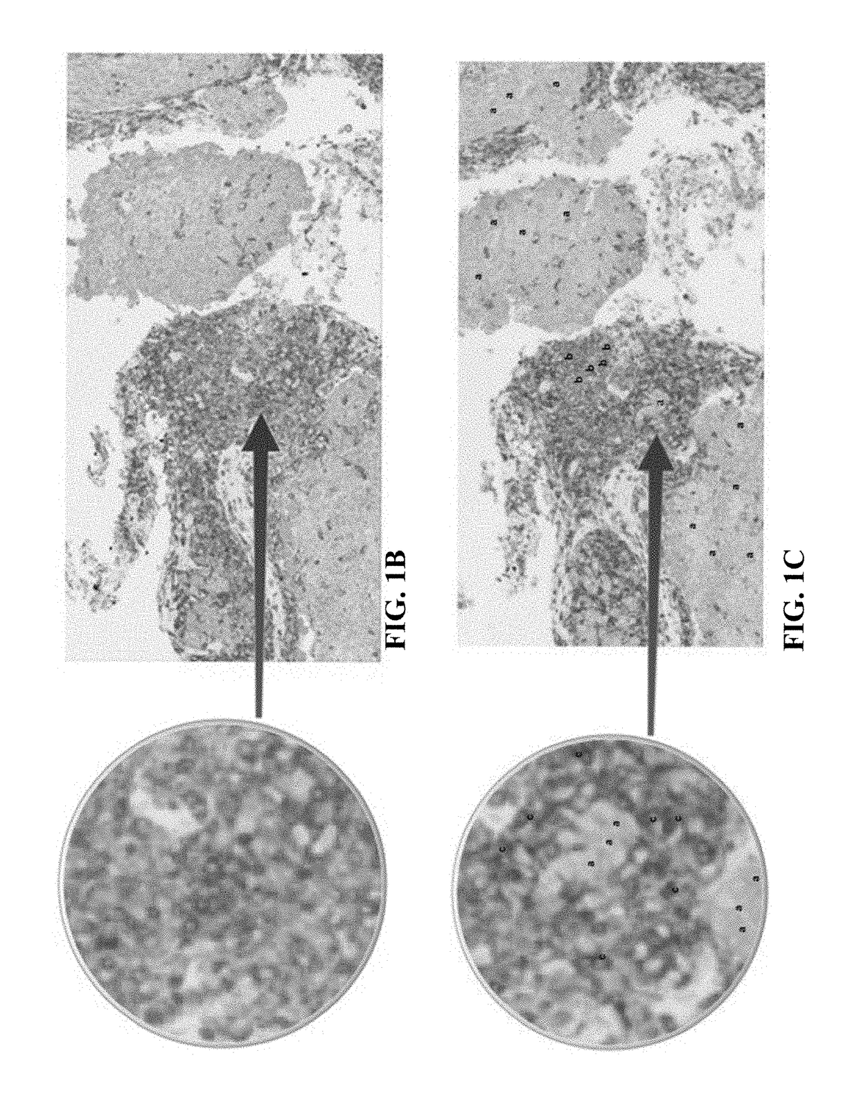 Methods of identifying immune cells in pd-l1 positive tumor tissue
