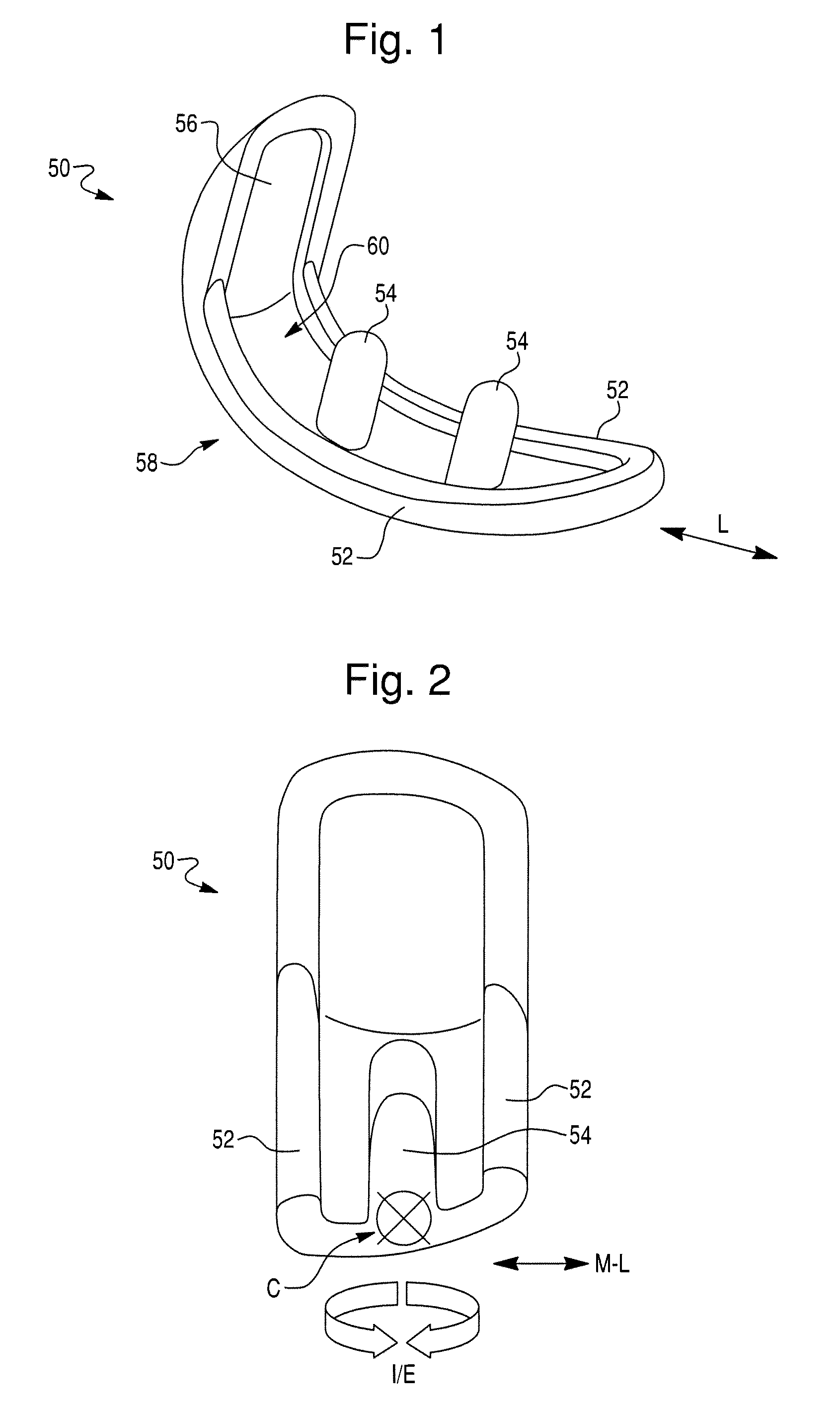 Prosthetic device for knee joint and methods of implanting and removing same