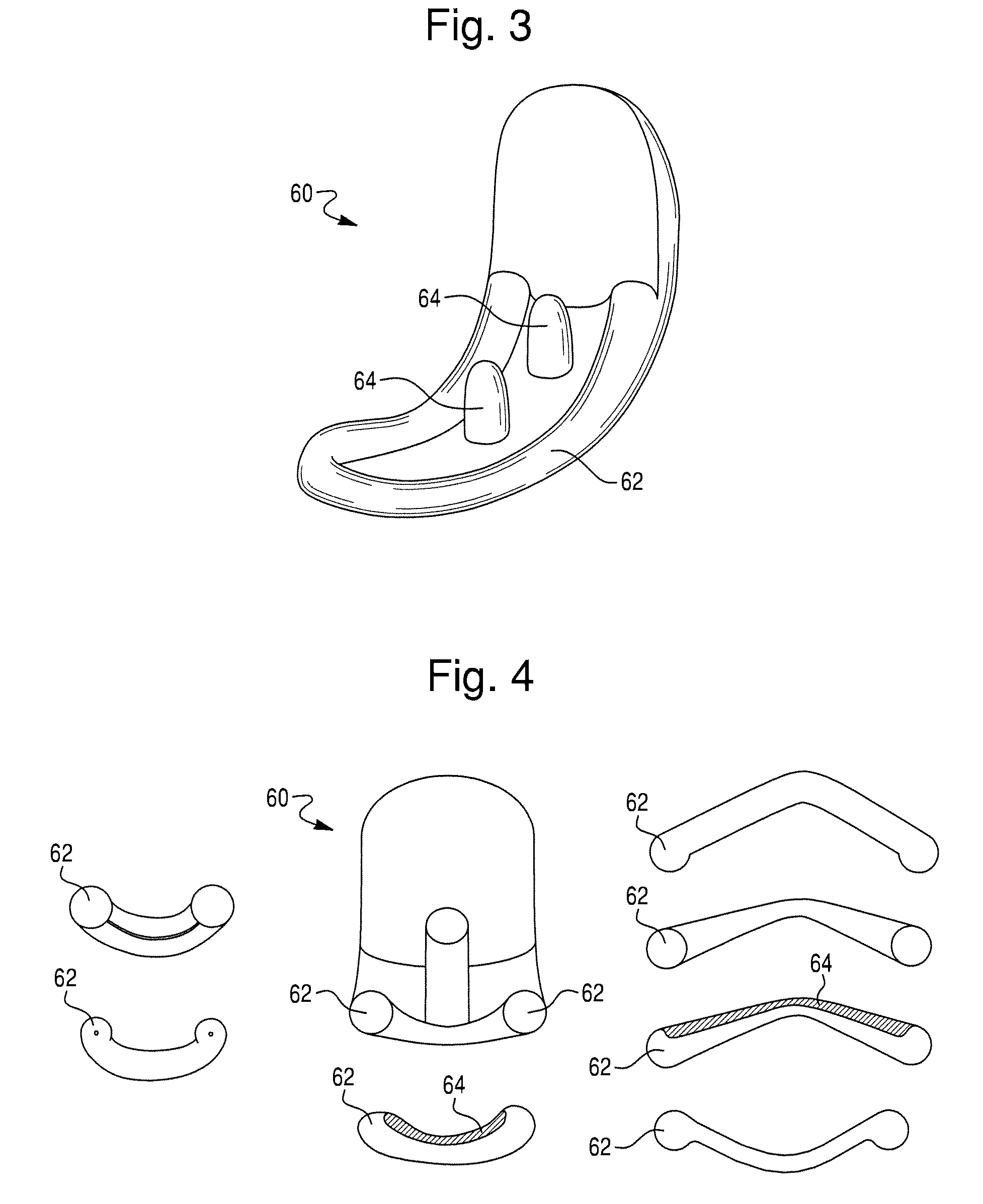 Prosthetic device for knee joint and methods of implanting and removing same