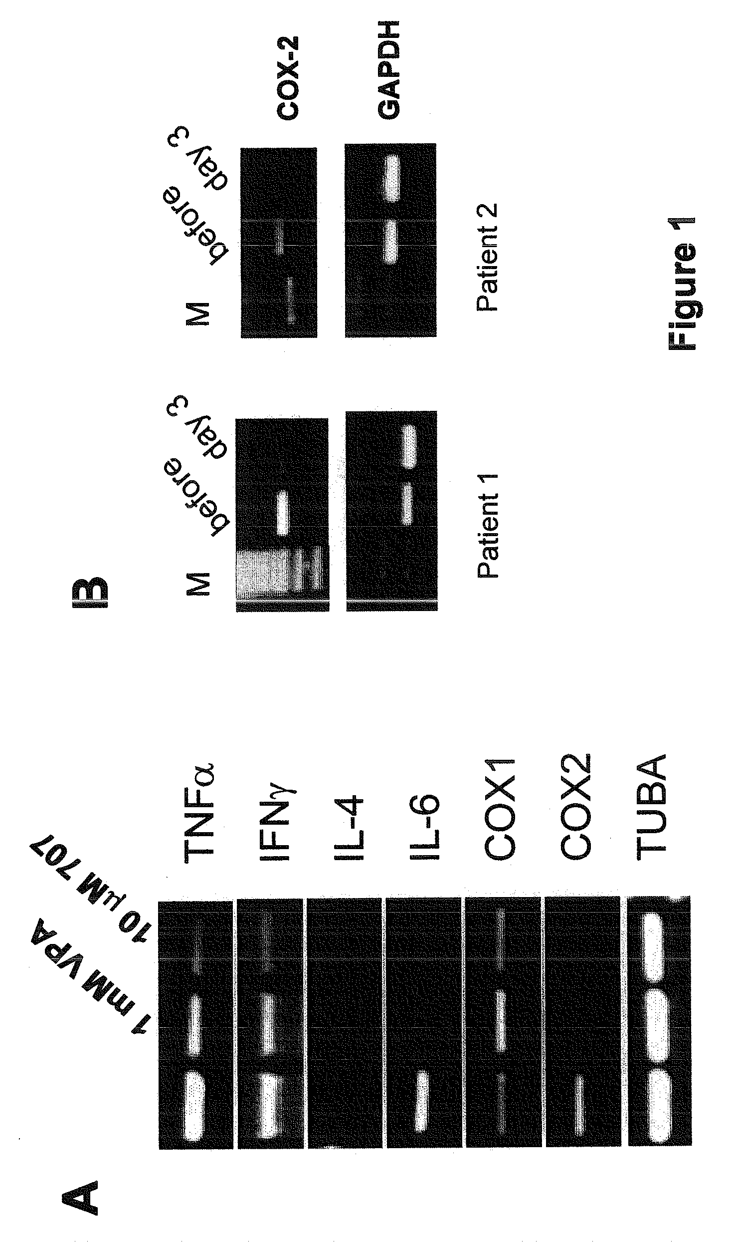 Use of Inhibitors of Histone Deacteylases in Combination With Compounds Acting as Nsaid for the Therapy of Human Diseases
