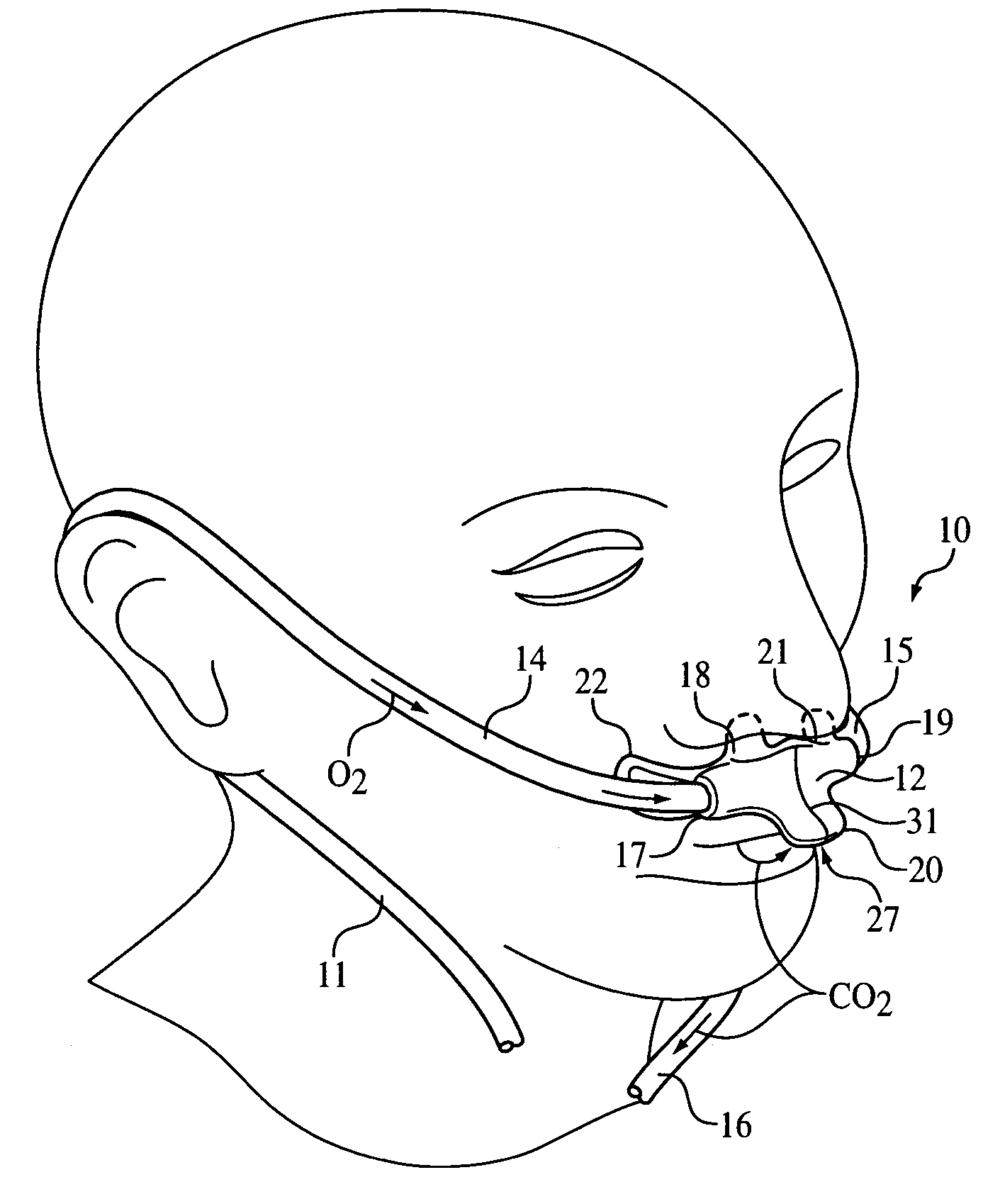 Nasal and oral patient interface