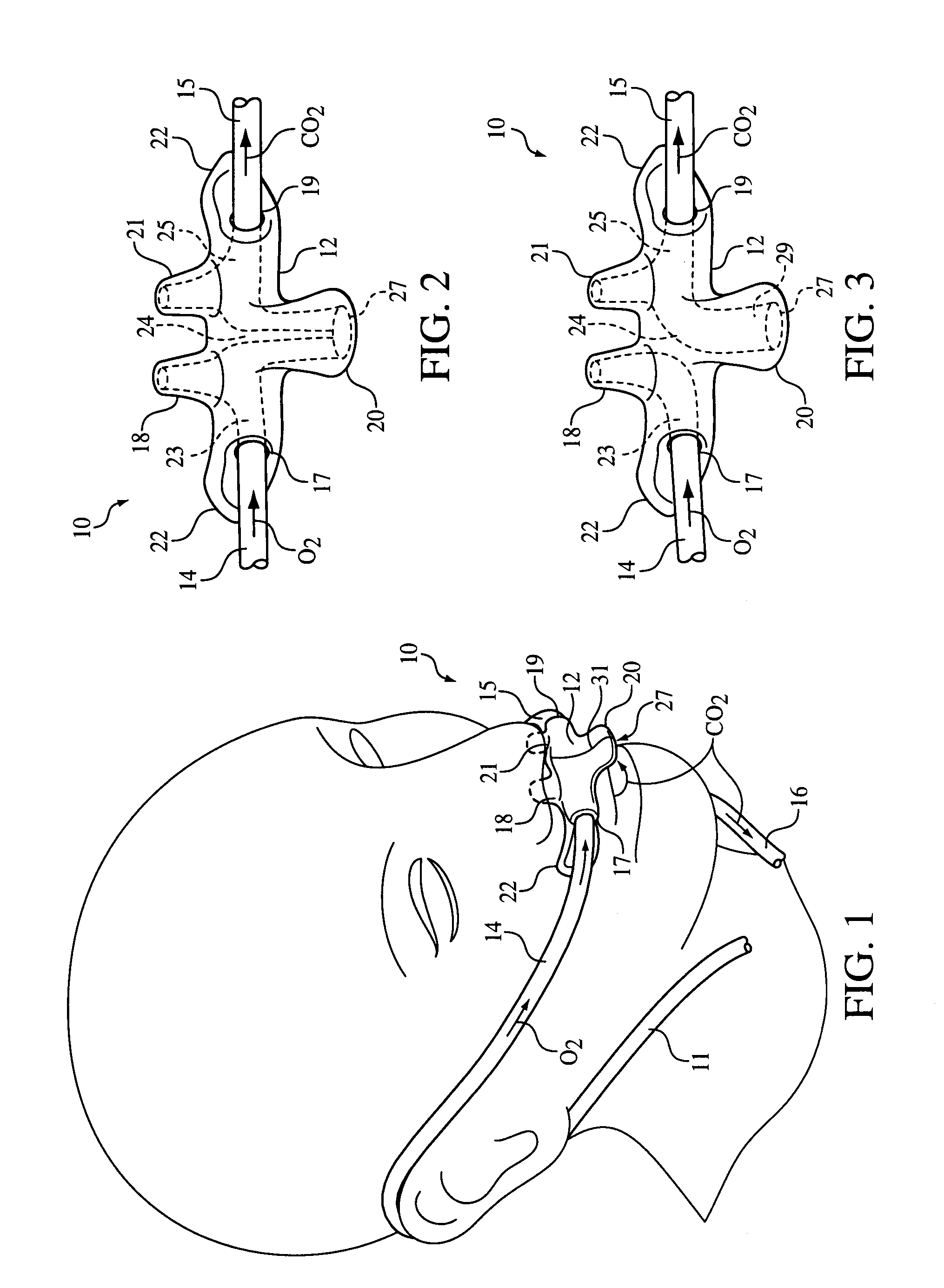Nasal and oral patient interface