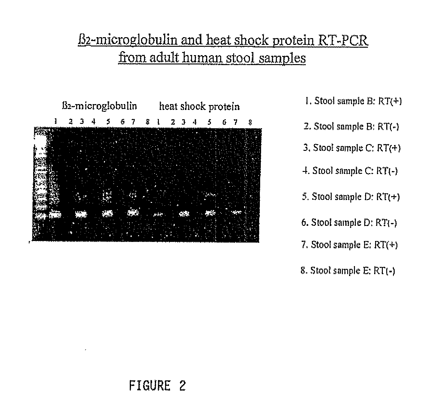 Method of isolating nucleic acids from stool samples