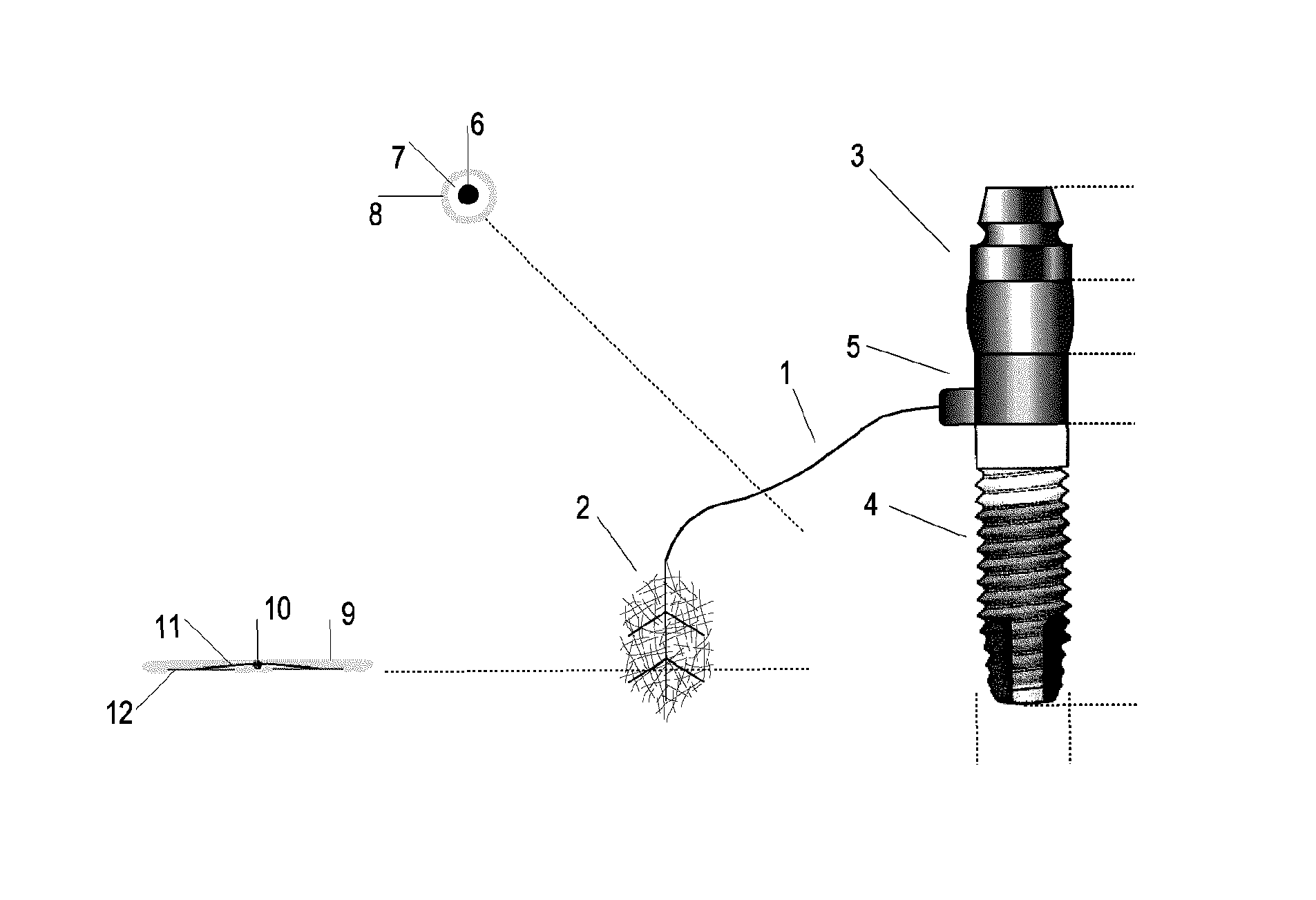 Bionic device of mastication sensitivity and of mandibular occlusion