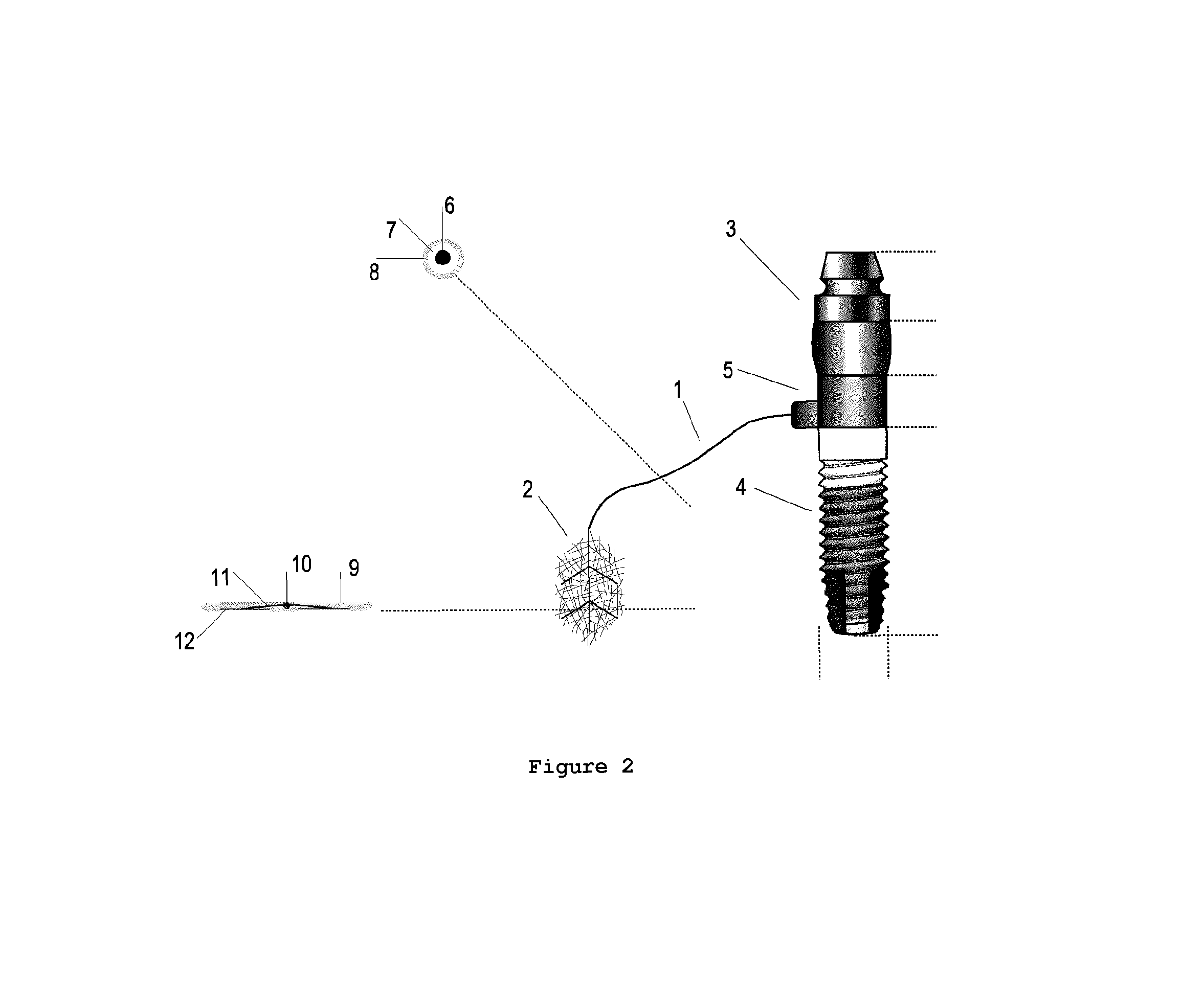 Bionic device of mastication sensitivity and of mandibular occlusion