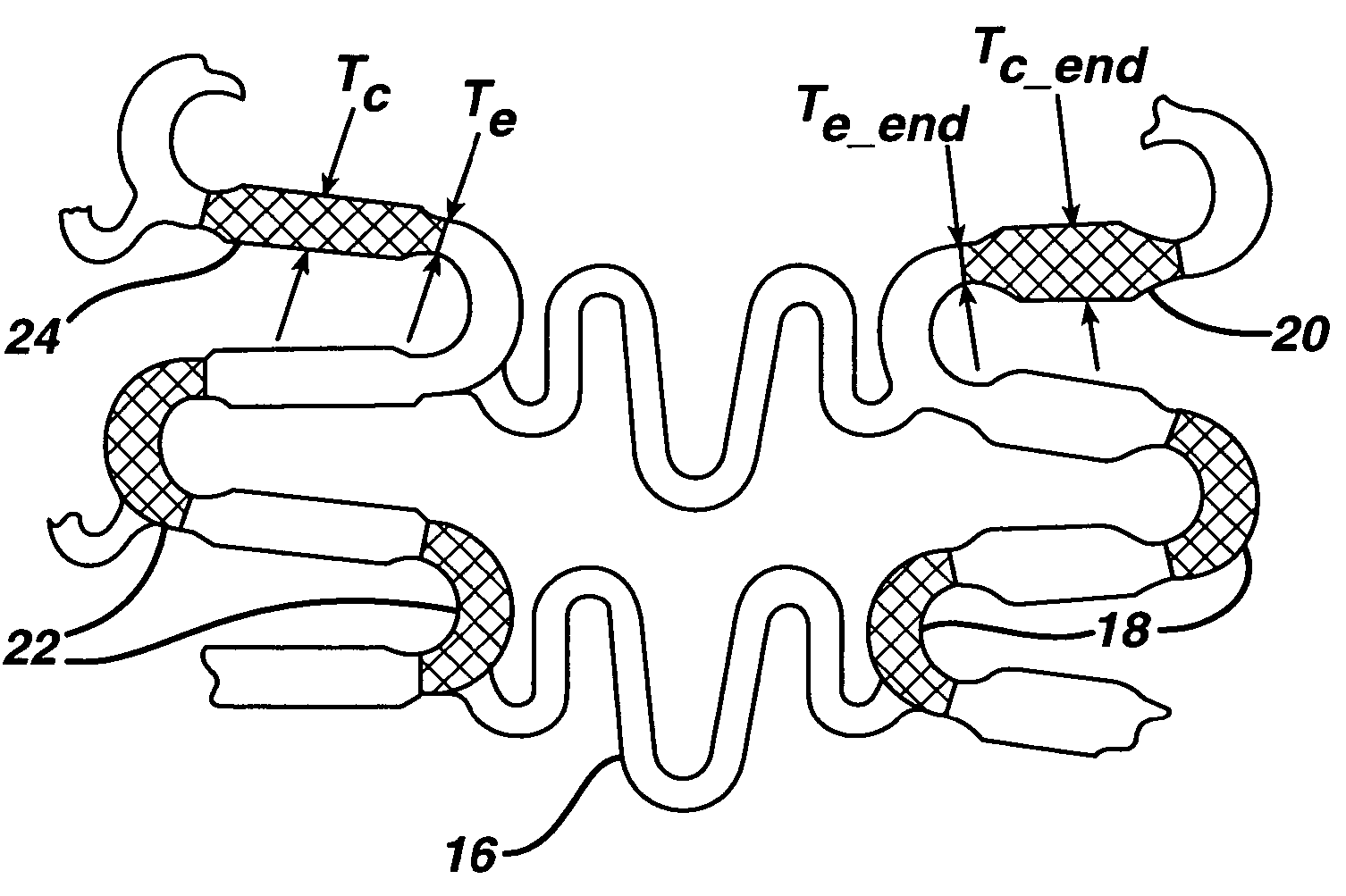 Magnetic resonance imaging compatibility alloy for implantable medical devices