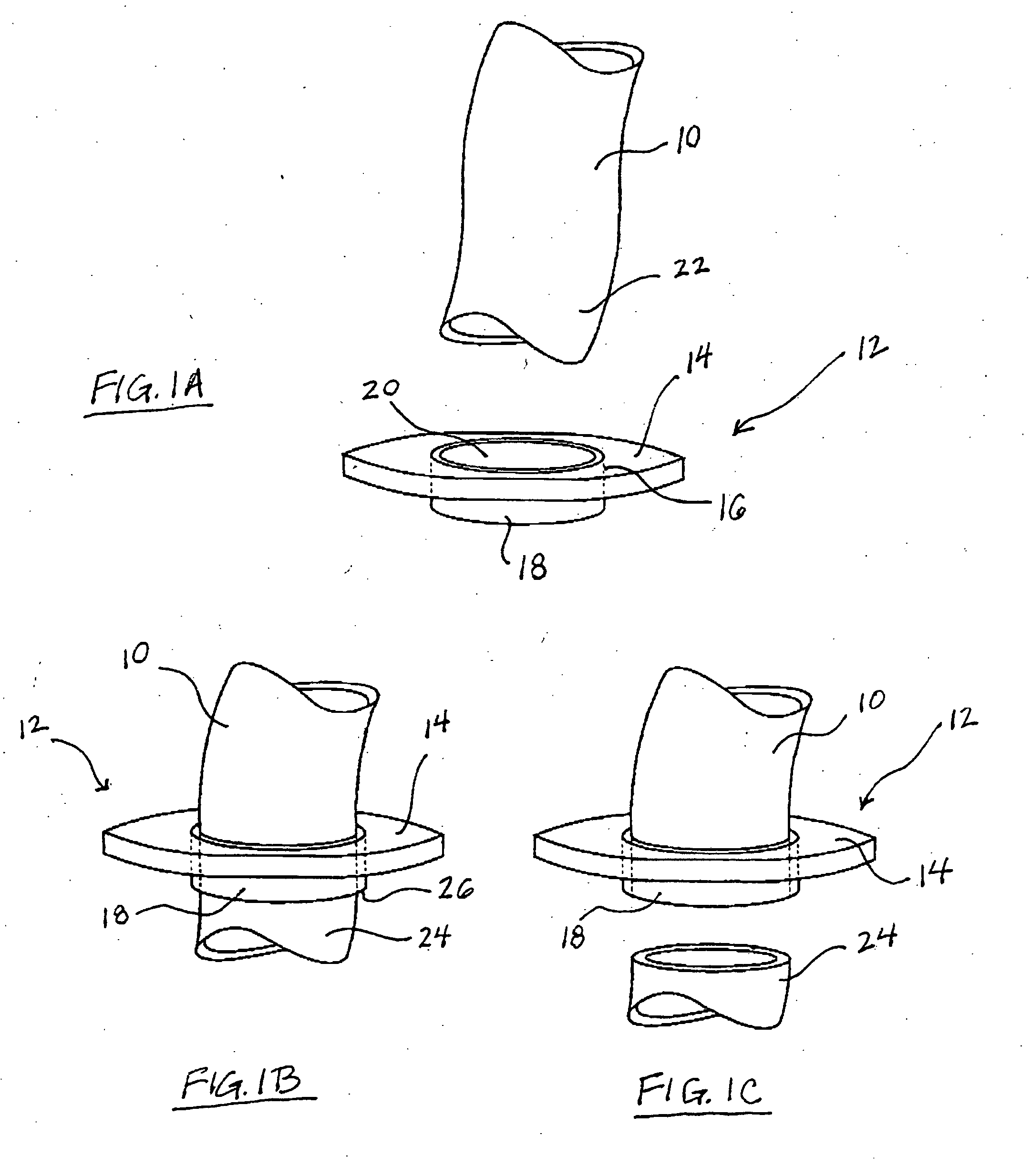 Components, systems, and methods for forming anastomoses using magnetism or other coupling means