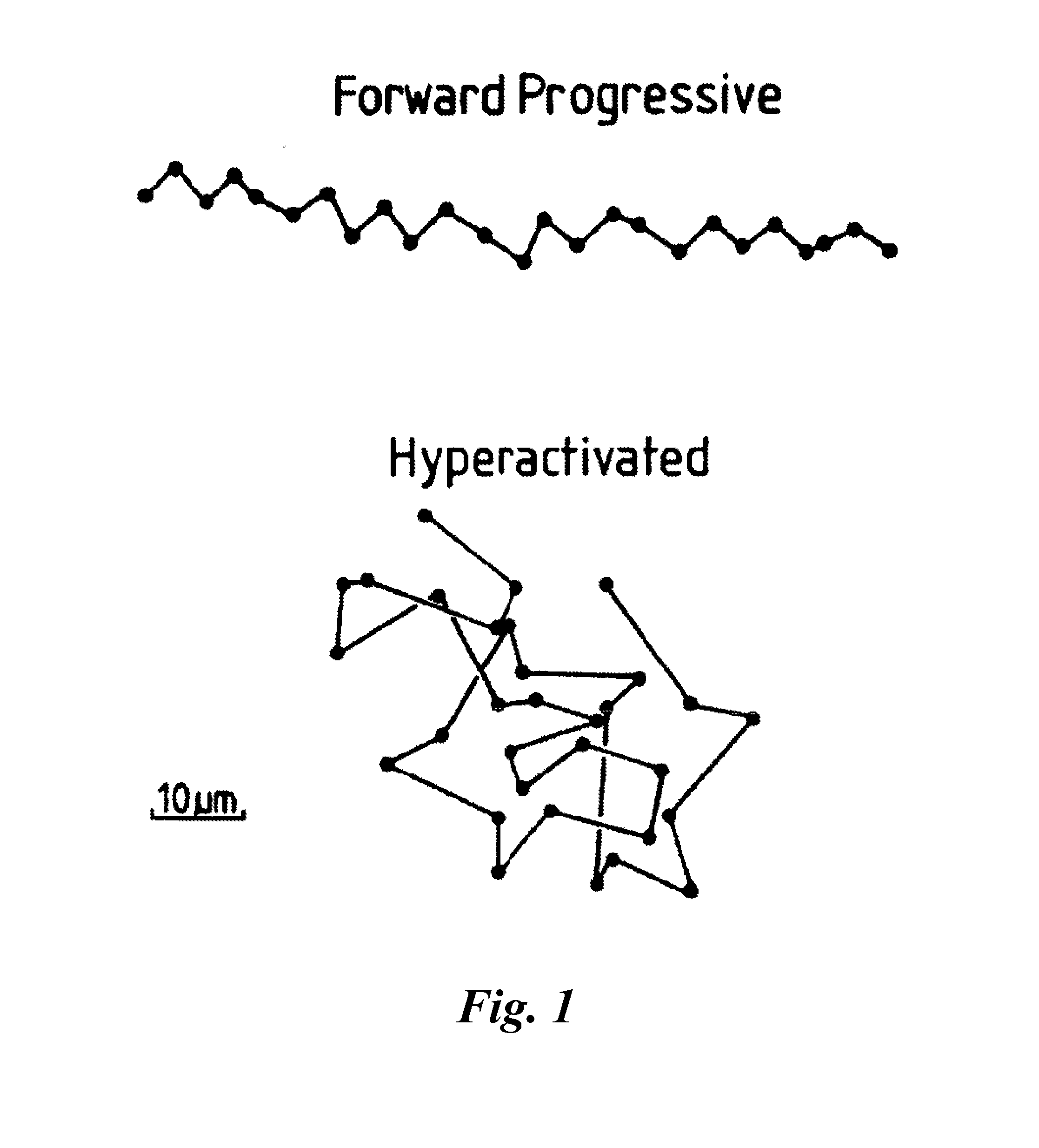 Modulators of sperm hypermobility and uses thereof