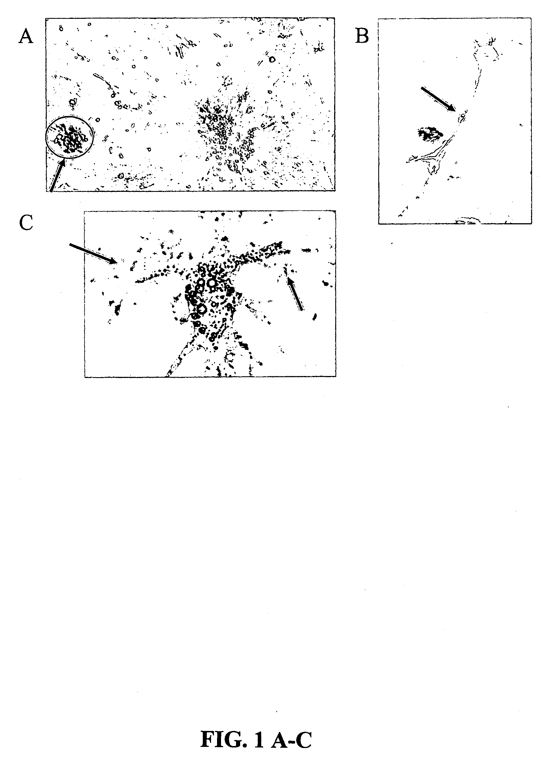 Cultures, products and methods using umbilical cord matrix cells