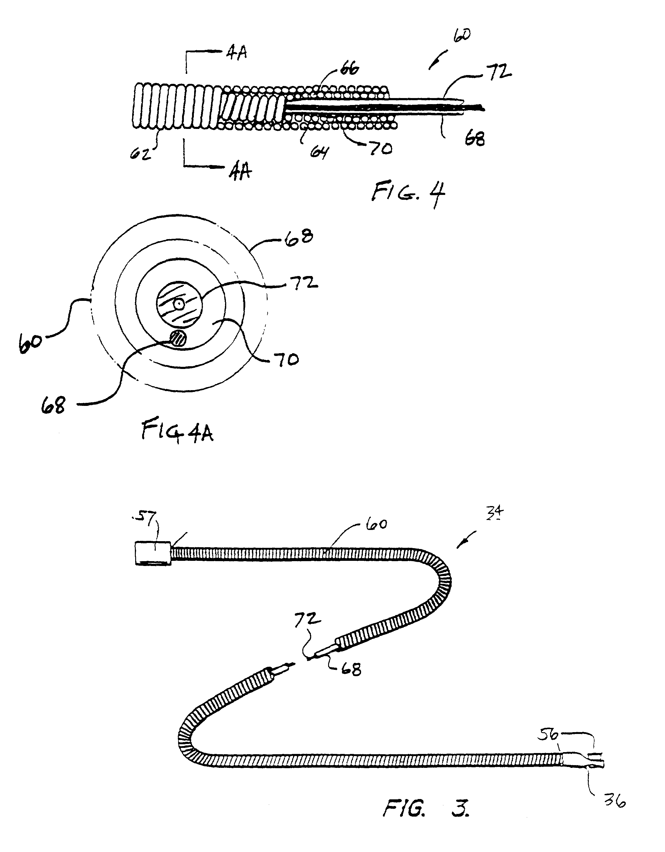 System and method for intraluminal imaging
