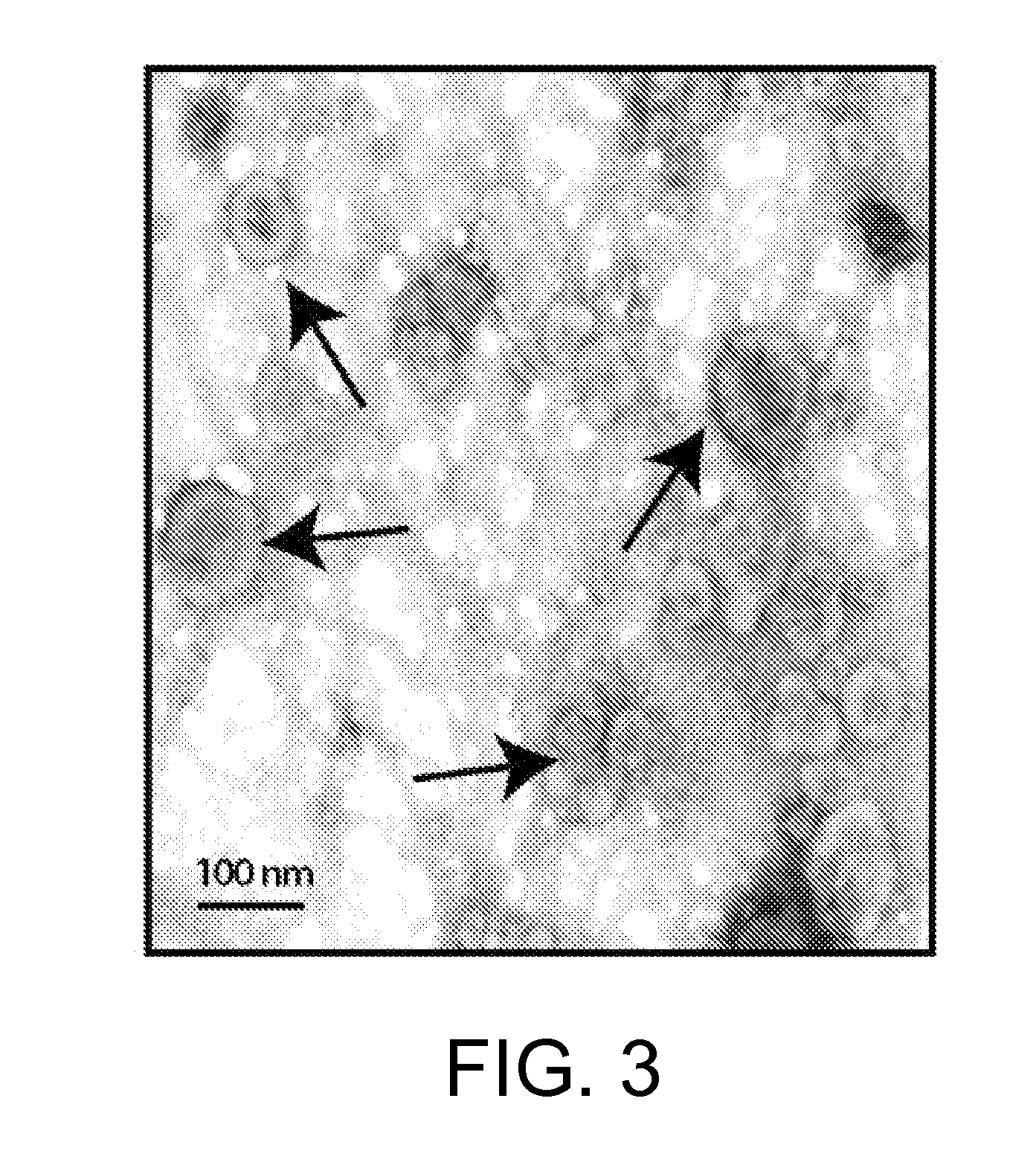 Methods for microvesicle isolation and selective removal