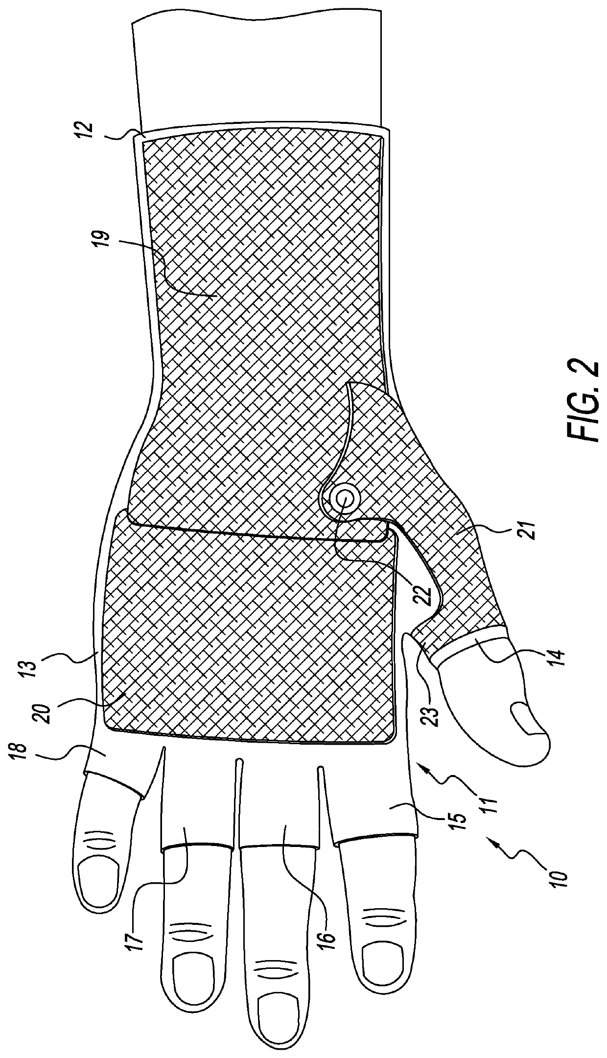 Hand orthoses