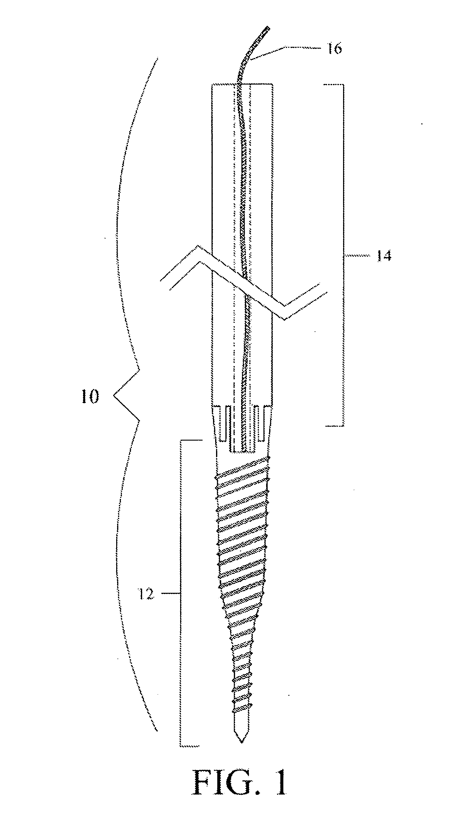 System and Method for Pedicle Screw Placement in Vertebral Alignment