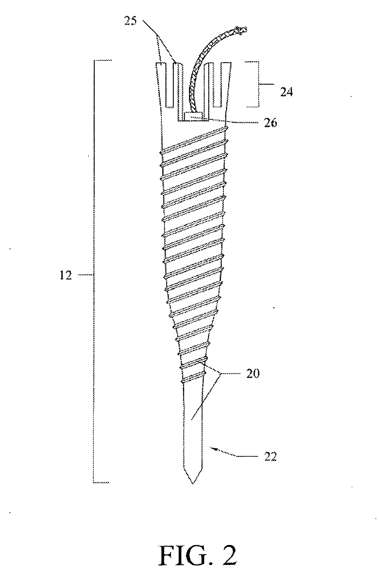System and Method for Pedicle Screw Placement in Vertebral Alignment