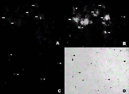 Pyrazine compounds, and medicinal application thereof