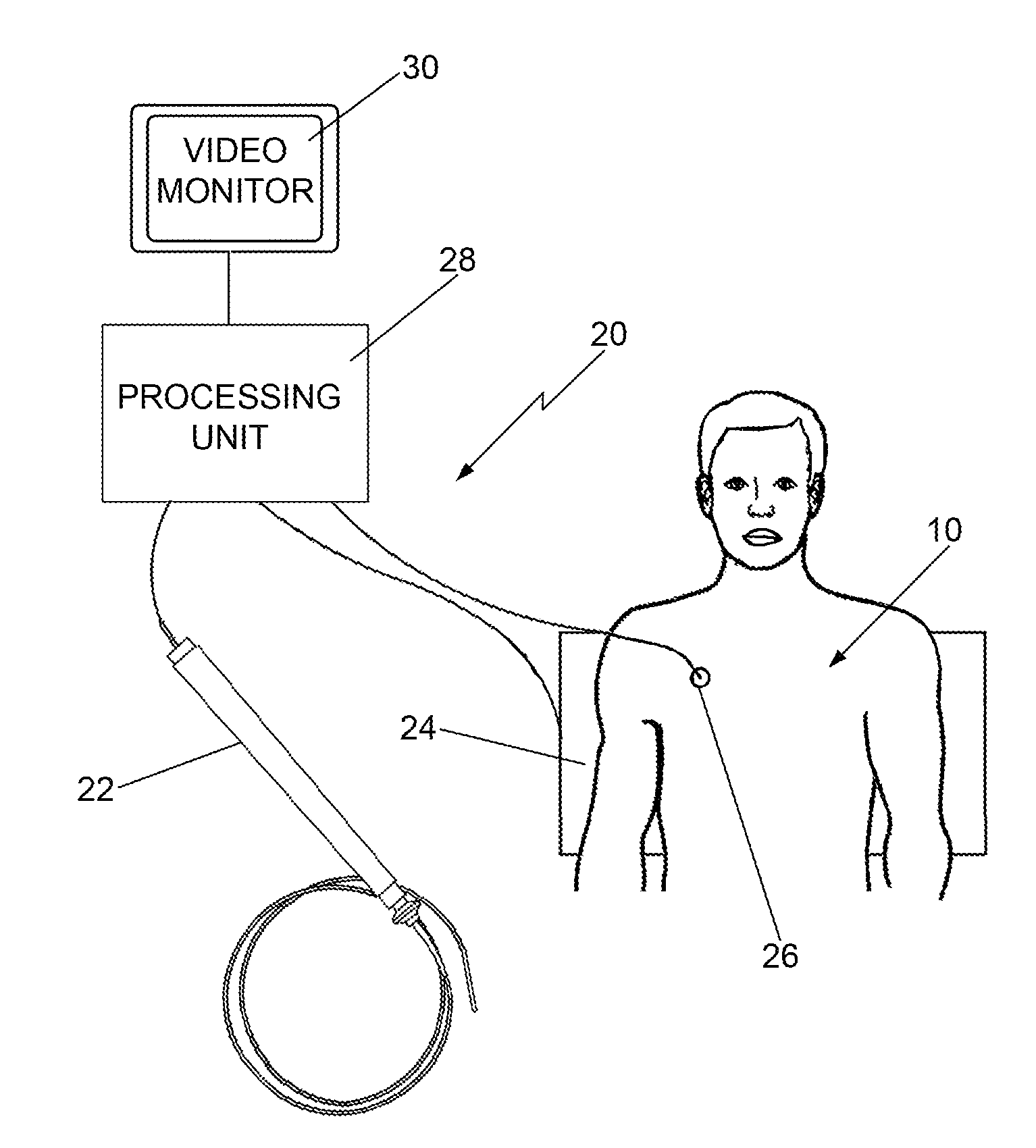 Cardio mapping system and method for cardio mapping