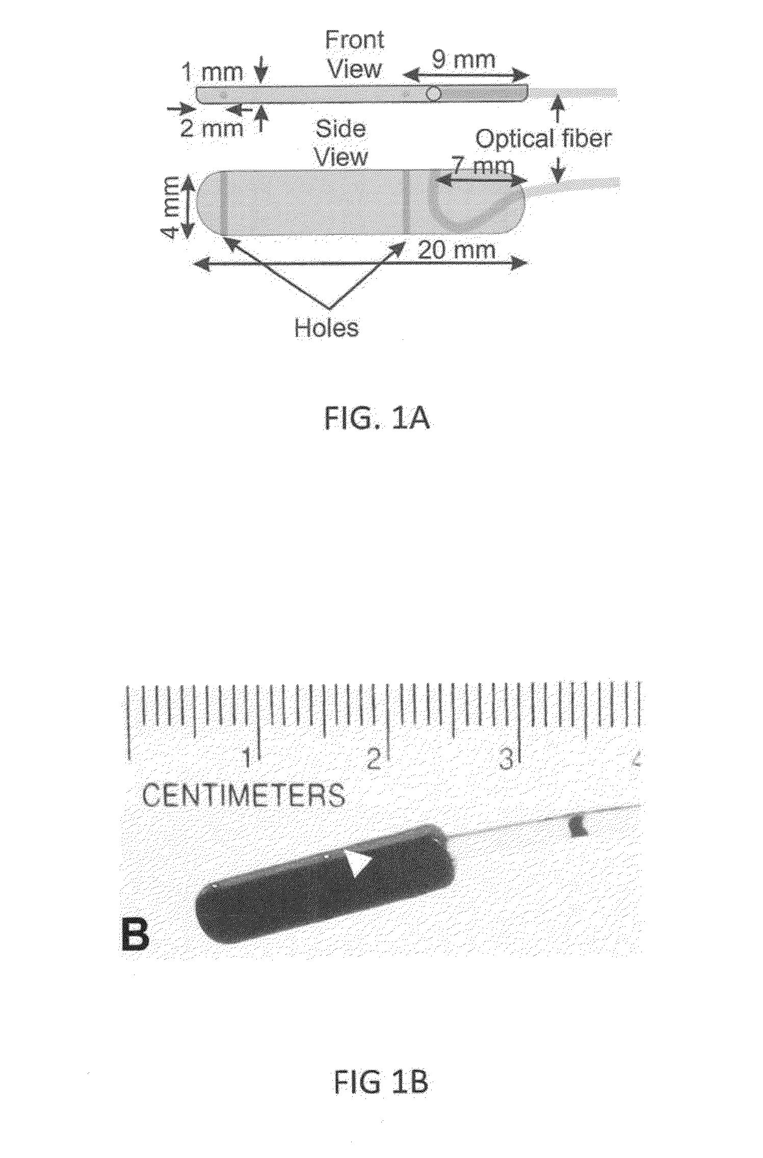 System, device and method for measurement of esophageal wall blood perfusion