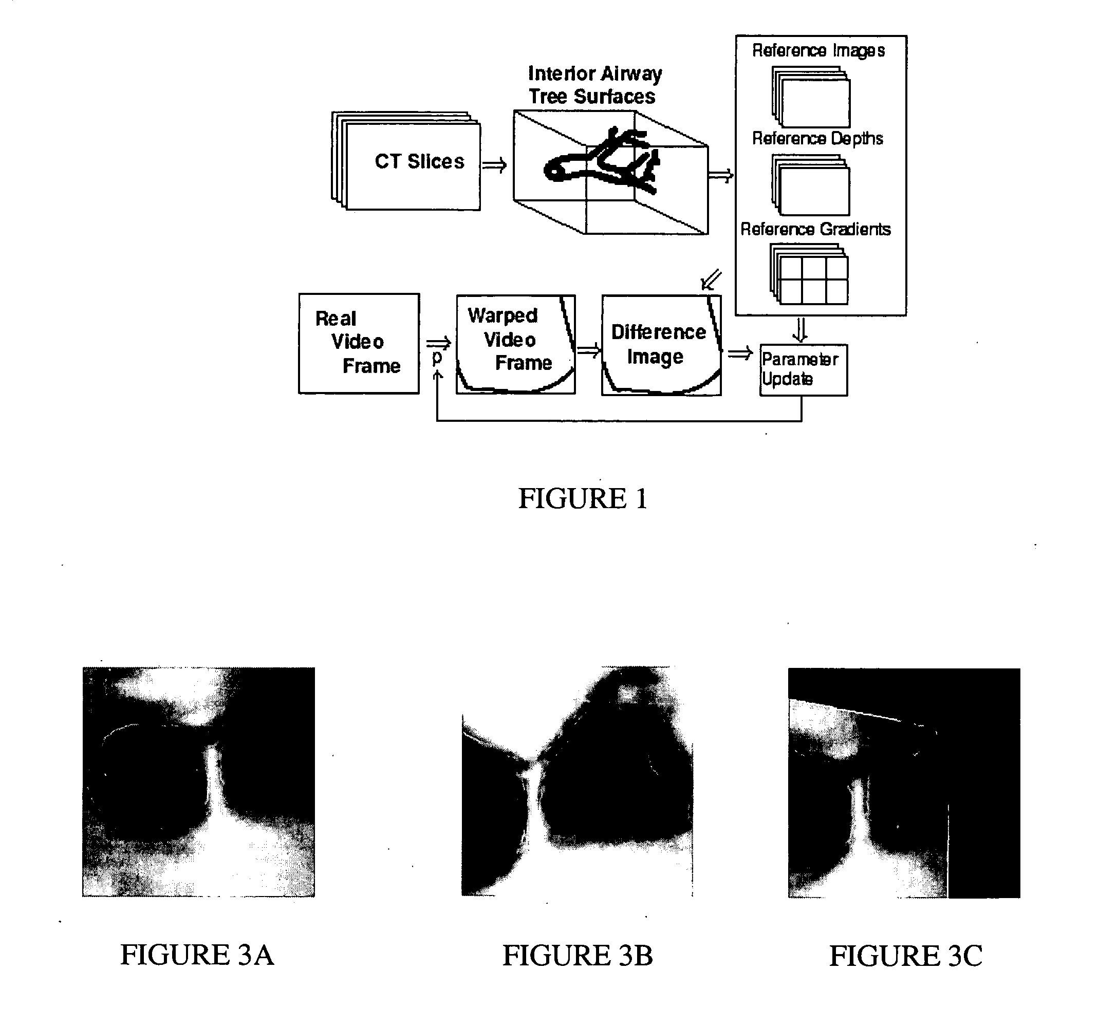 Fast 3D-2D image registration method with application to continuously guided endoscopy