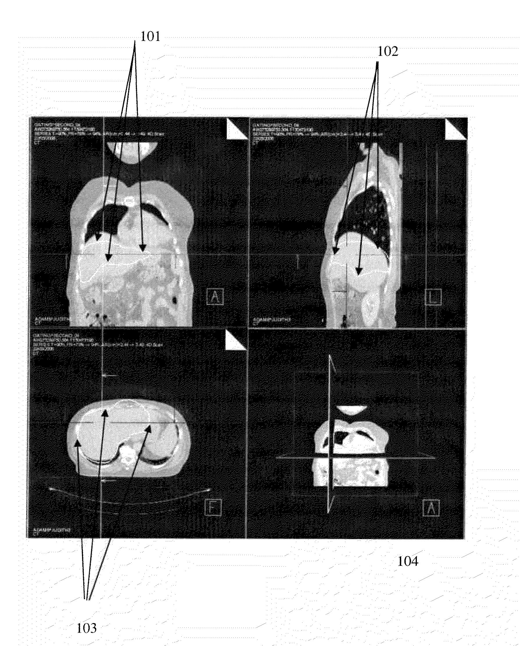 Methods and systems for fully automatic segmentation of medical images