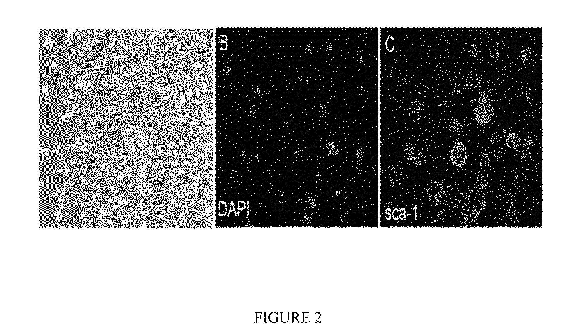 Differentiation of mesenchymal stem cells into fibroblasts, compositions comprising mesenchymal stem cell-derived fibroblasts, and methods of using the same