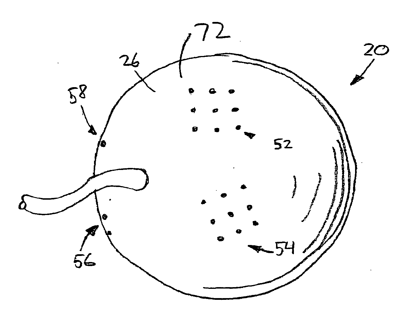 System and method for treating connective tissue