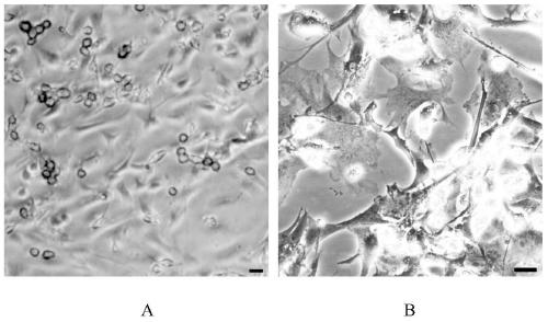 A kind of naked mole rat oligodendrocyte precursor cell culture method