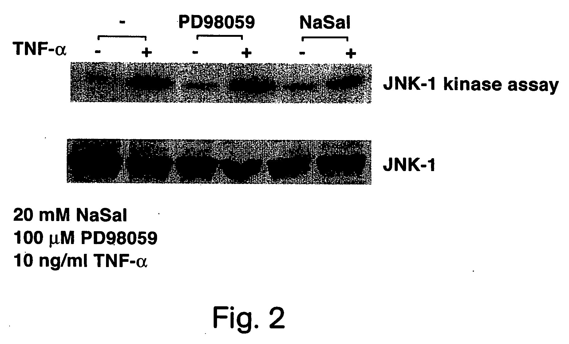 Methods for treating and preventing insulin resistance and related disorders
