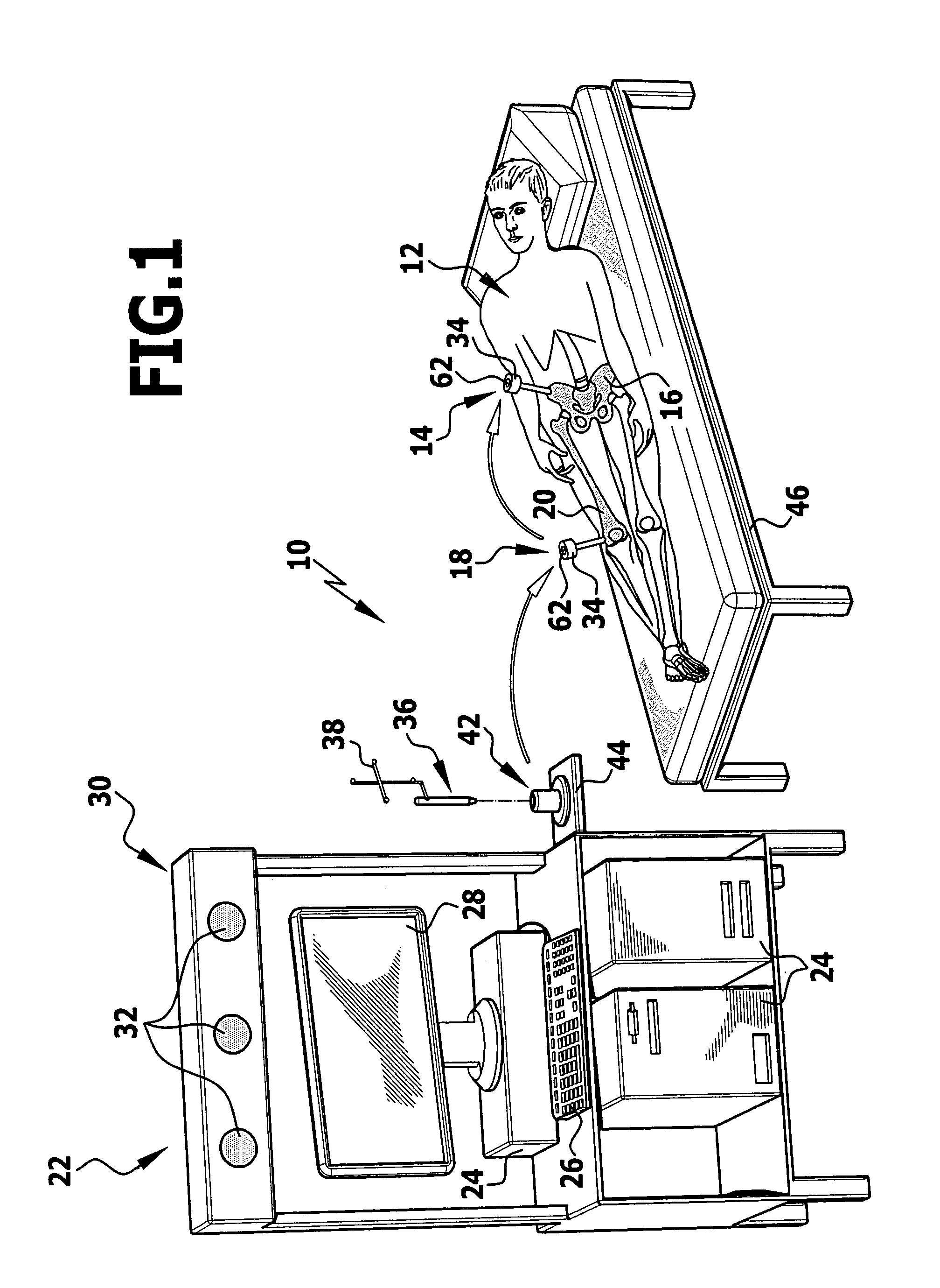 Calibration method and calibration device for a surgical referencing unit
