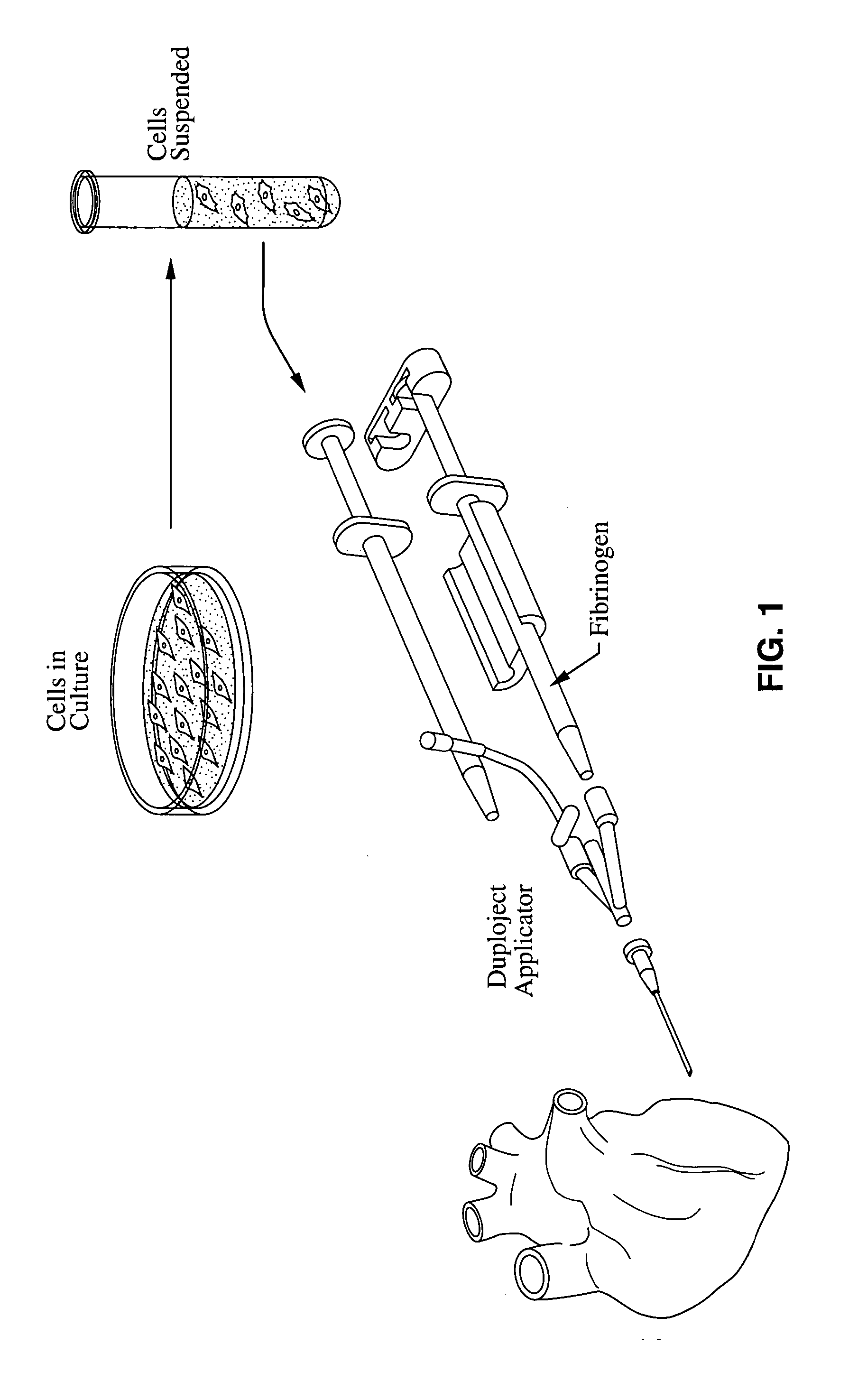 Material compositions and related systems and methods for treating cardiac conditions
